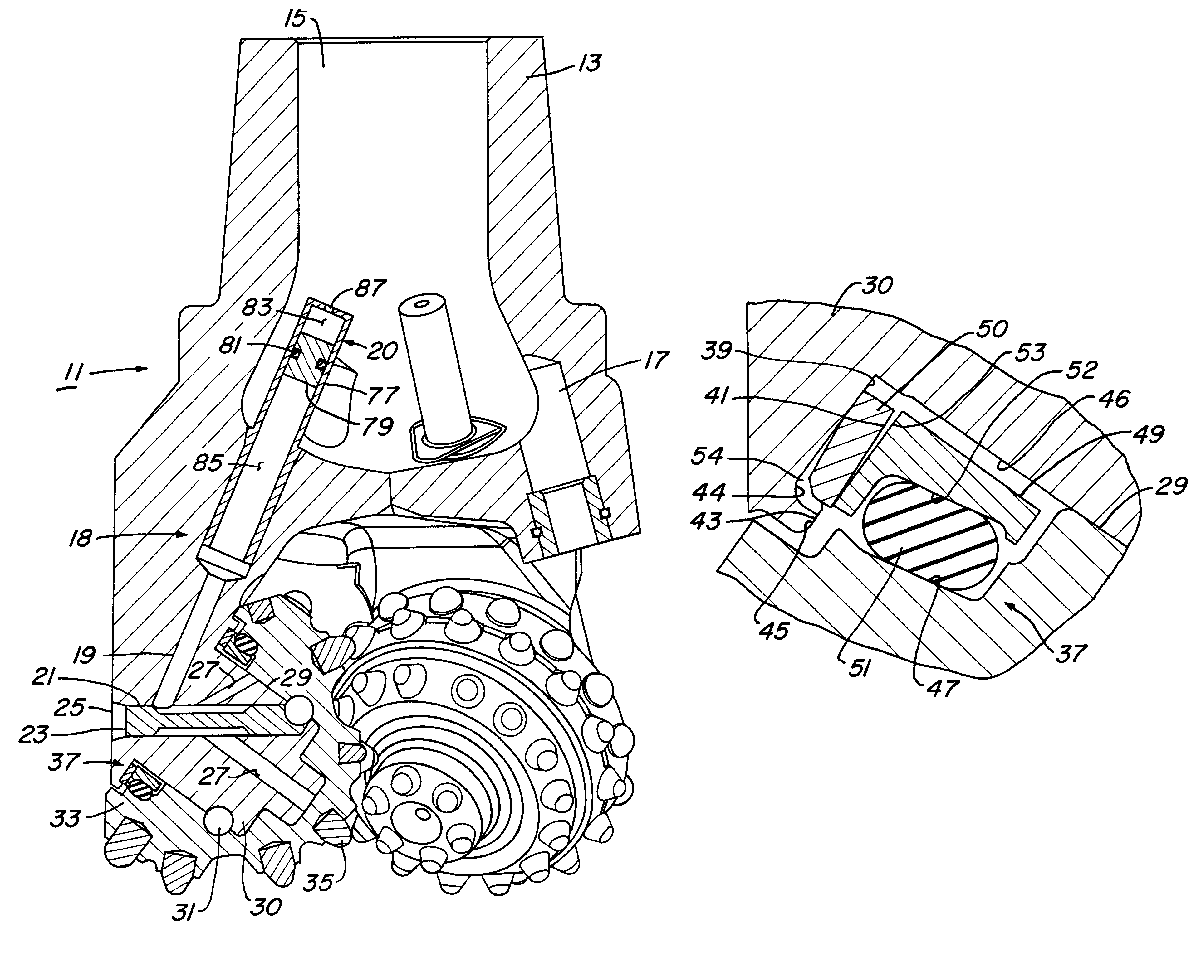 Metal-face-seal rock bit