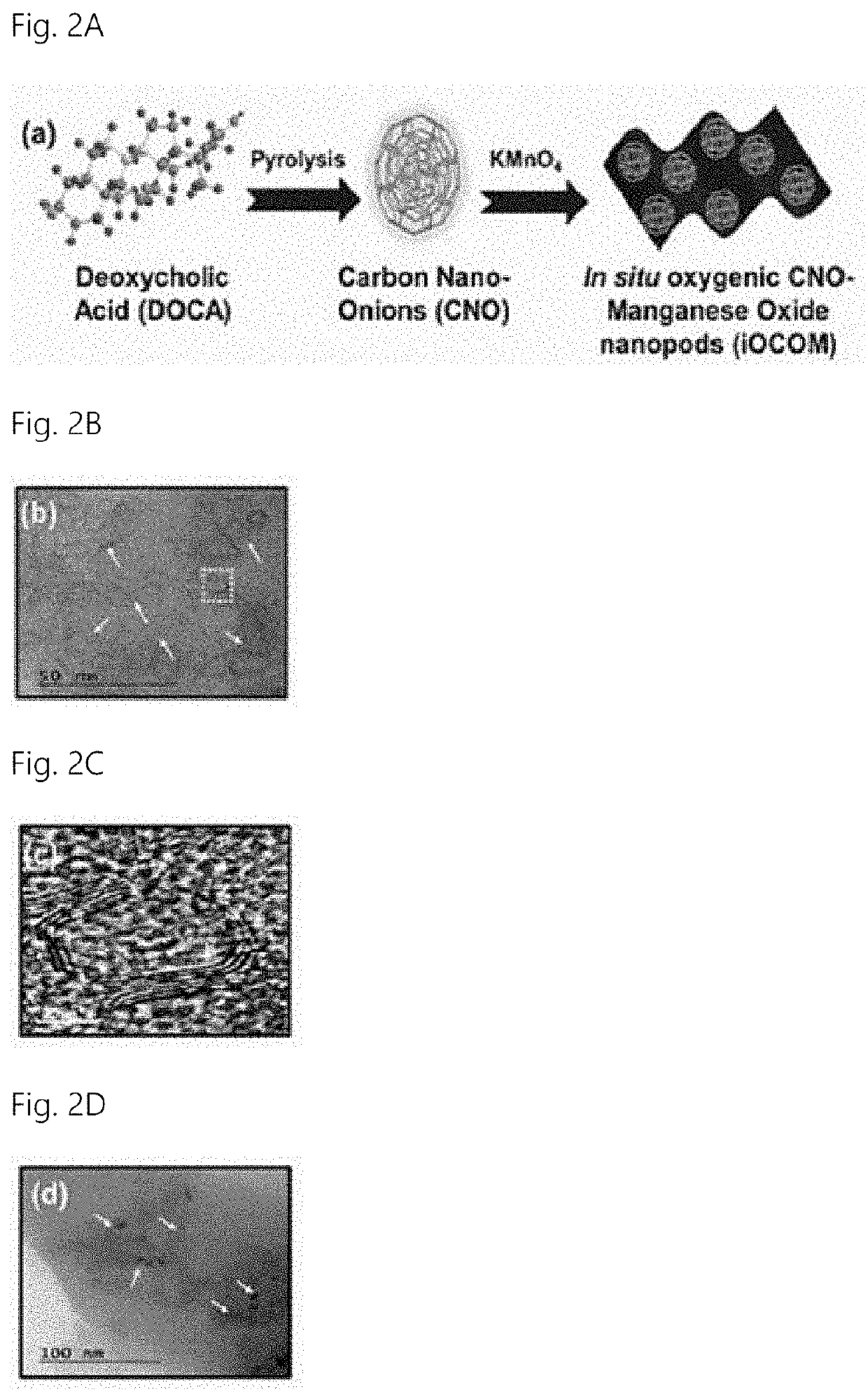 Tumor microenvironment-responsive nanacomplex and anticancer composition comprising same