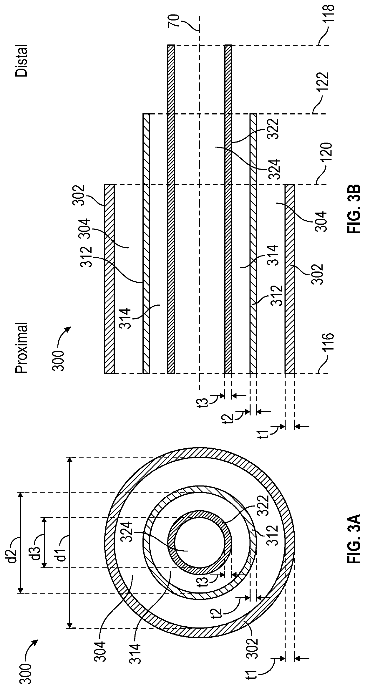 Coaxial Multi-Lumen Catheter