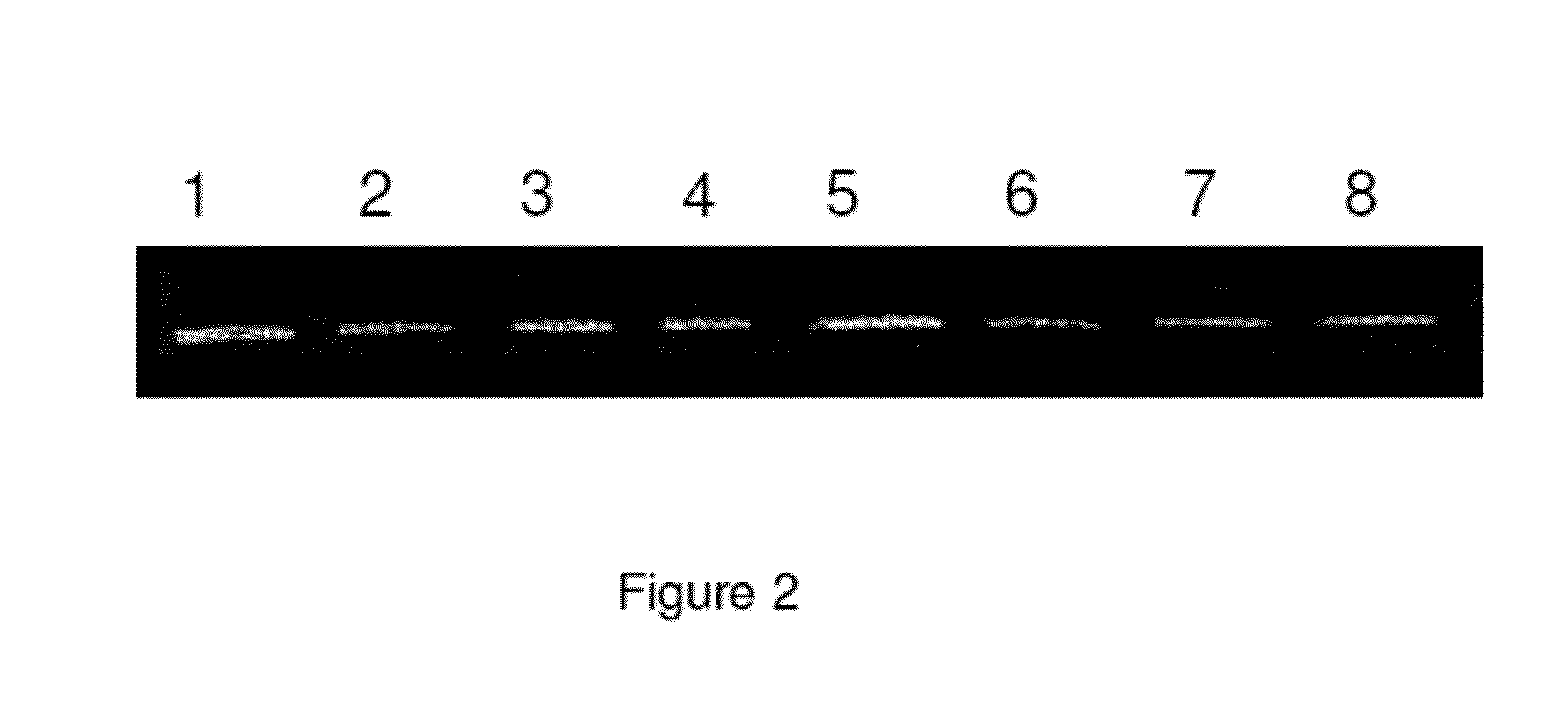 Method for the detection of schizophrenia related gene transcripts in blood