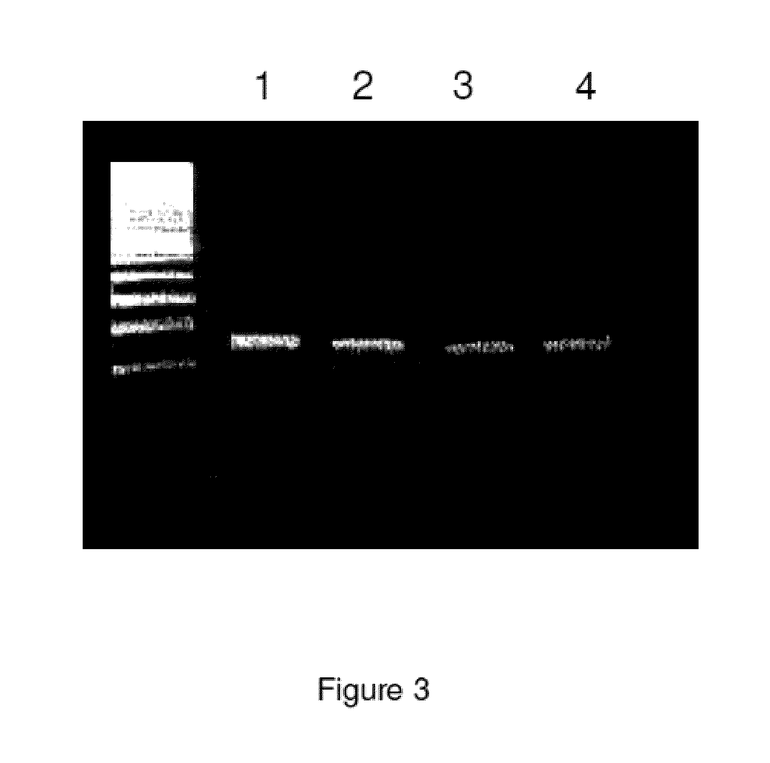 Method for the detection of schizophrenia related gene transcripts in blood