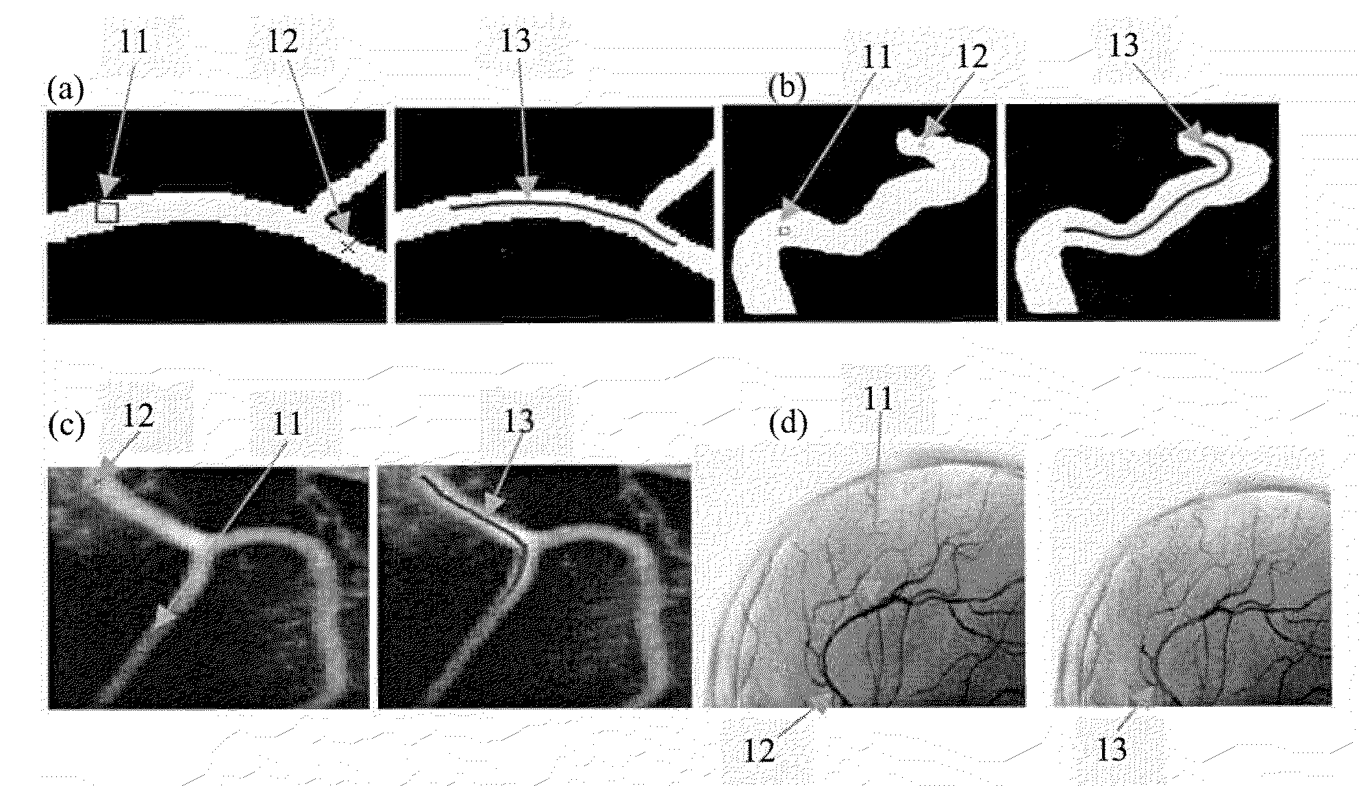 System and Method for Robust Segmentation of Tubular Structures in 2D and 3D Images