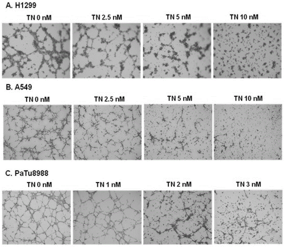 Application of triptolide in anti-angiogenesis drugs