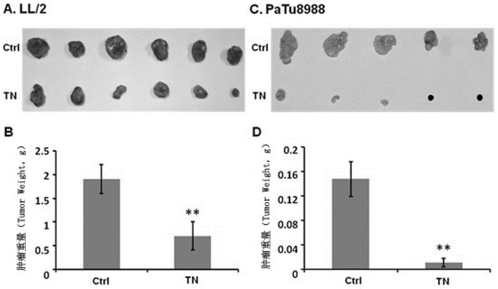 Application of triptolide in anti-angiogenesis drugs