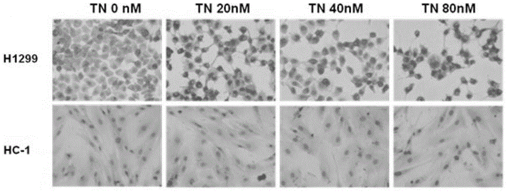 Application of triptolide in anti-angiogenesis drugs