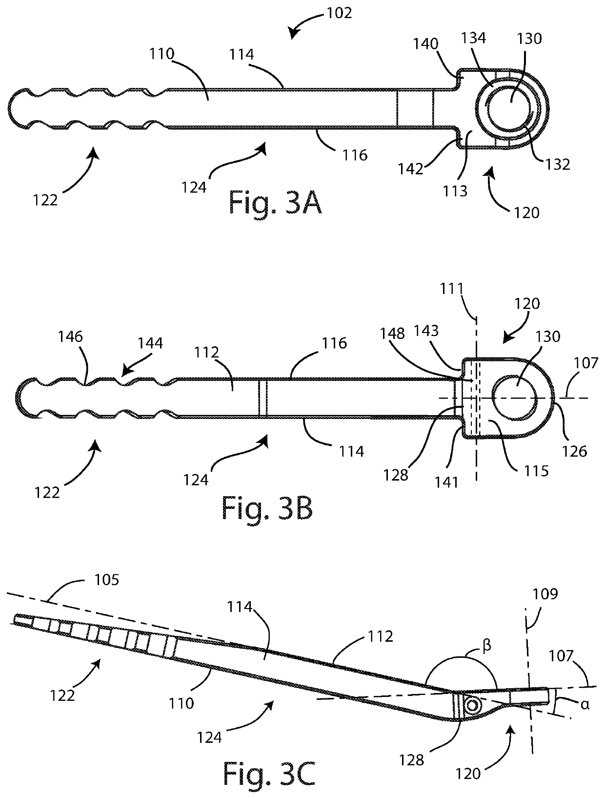 Bunion correction system and method