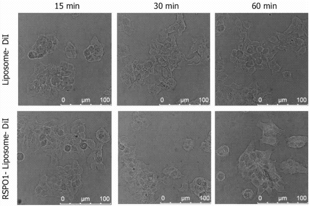 RSPO1-containing targeted drug delivery system, preparation and applications thereof