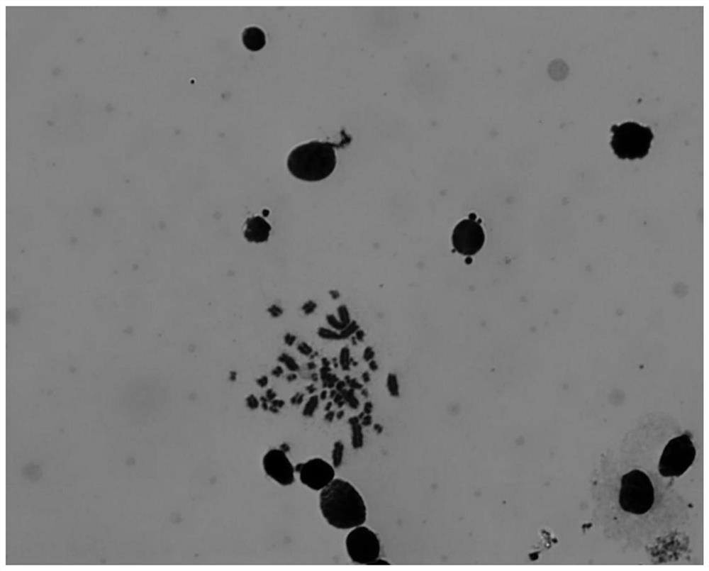 A kind of method of using peripheral blood cell to prepare electrochromosomal sample