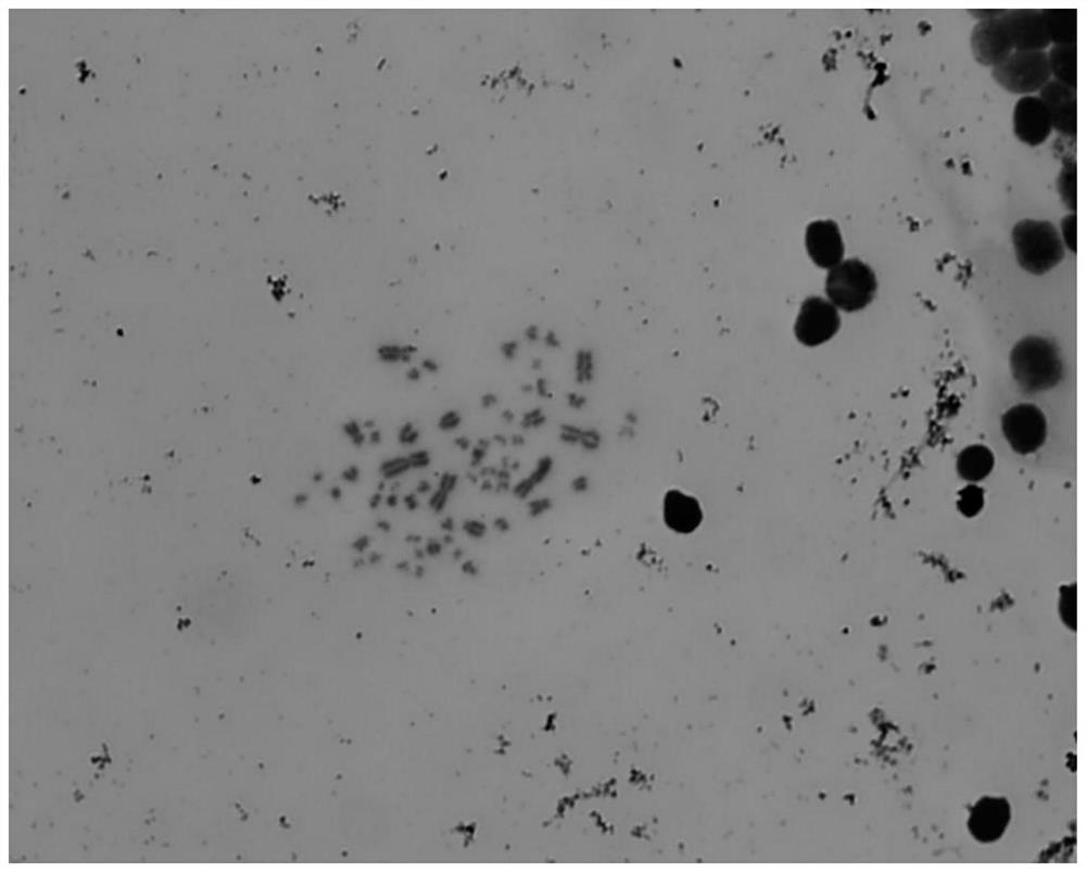 A kind of method of using peripheral blood cell to prepare electrochromosomal sample