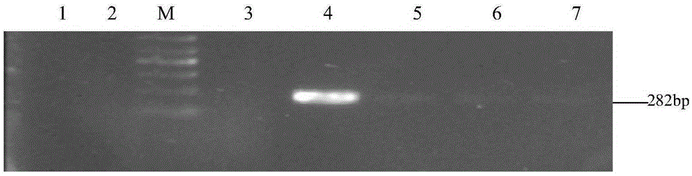 Fluorescent quantitative PCR detection kit for quickly detecting pythium aphanidermatum