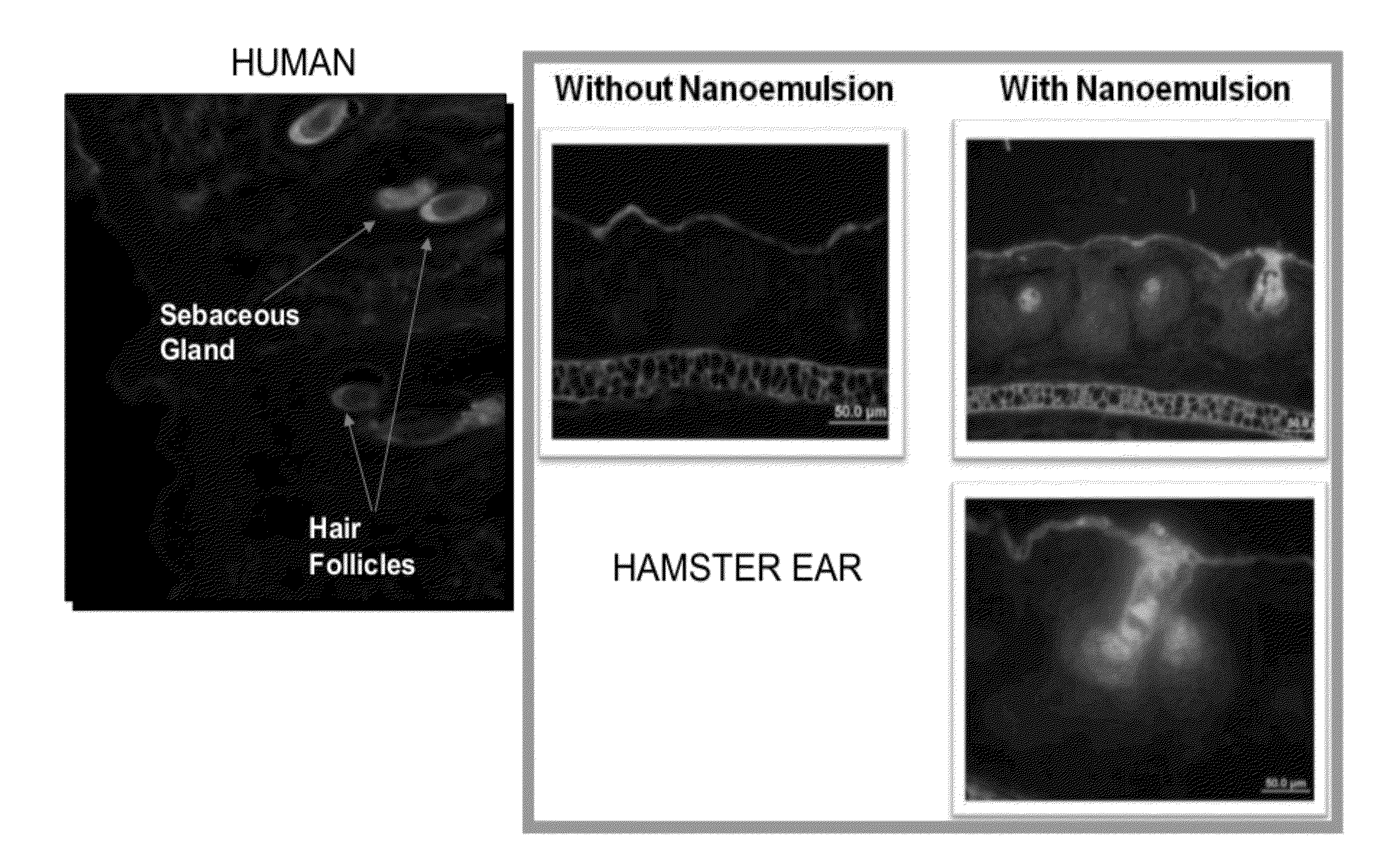 Anti-aging and wrinkle treatment methods using nanoemulsion compositions