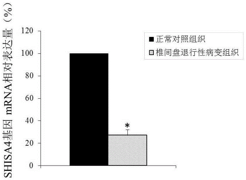 Application of gene SHISA4 as intervertebral disc degenerative change diagnosis and treatment marker