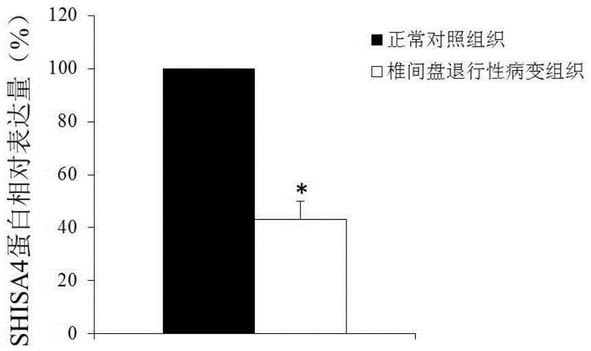 Application of gene SHISA4 as intervertebral disc degenerative change diagnosis and treatment marker