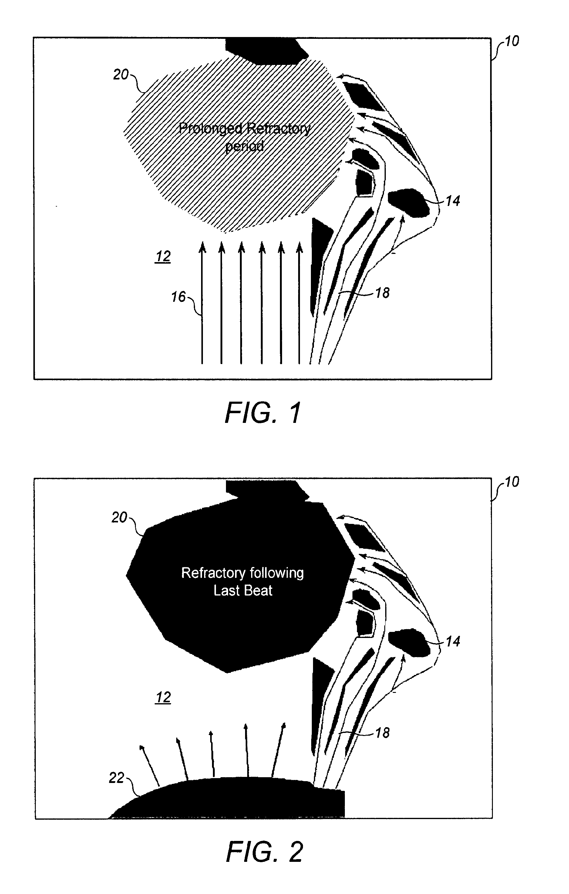 System for analysis of electrograms