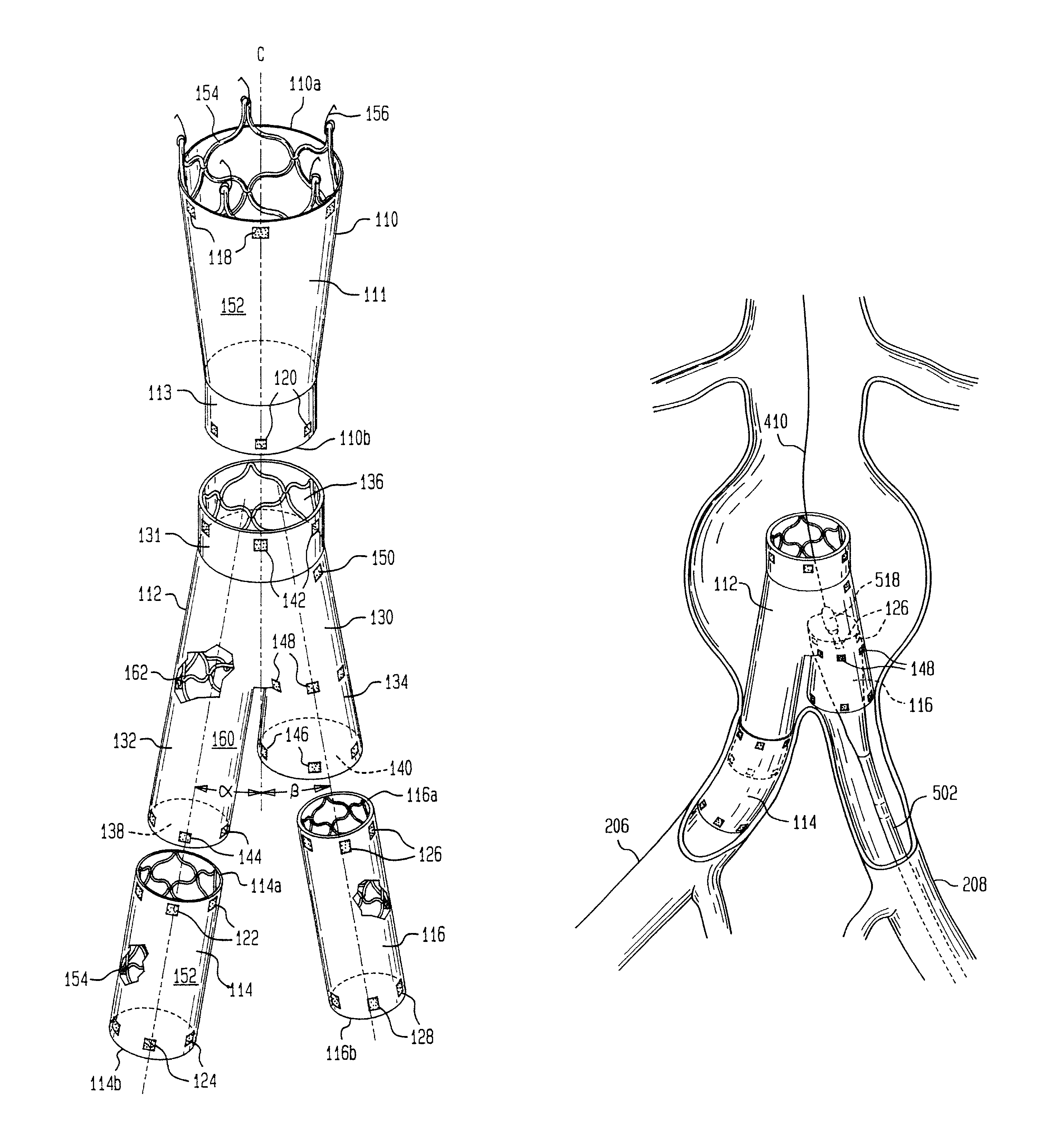 Bifurcated graft with an inferior extension