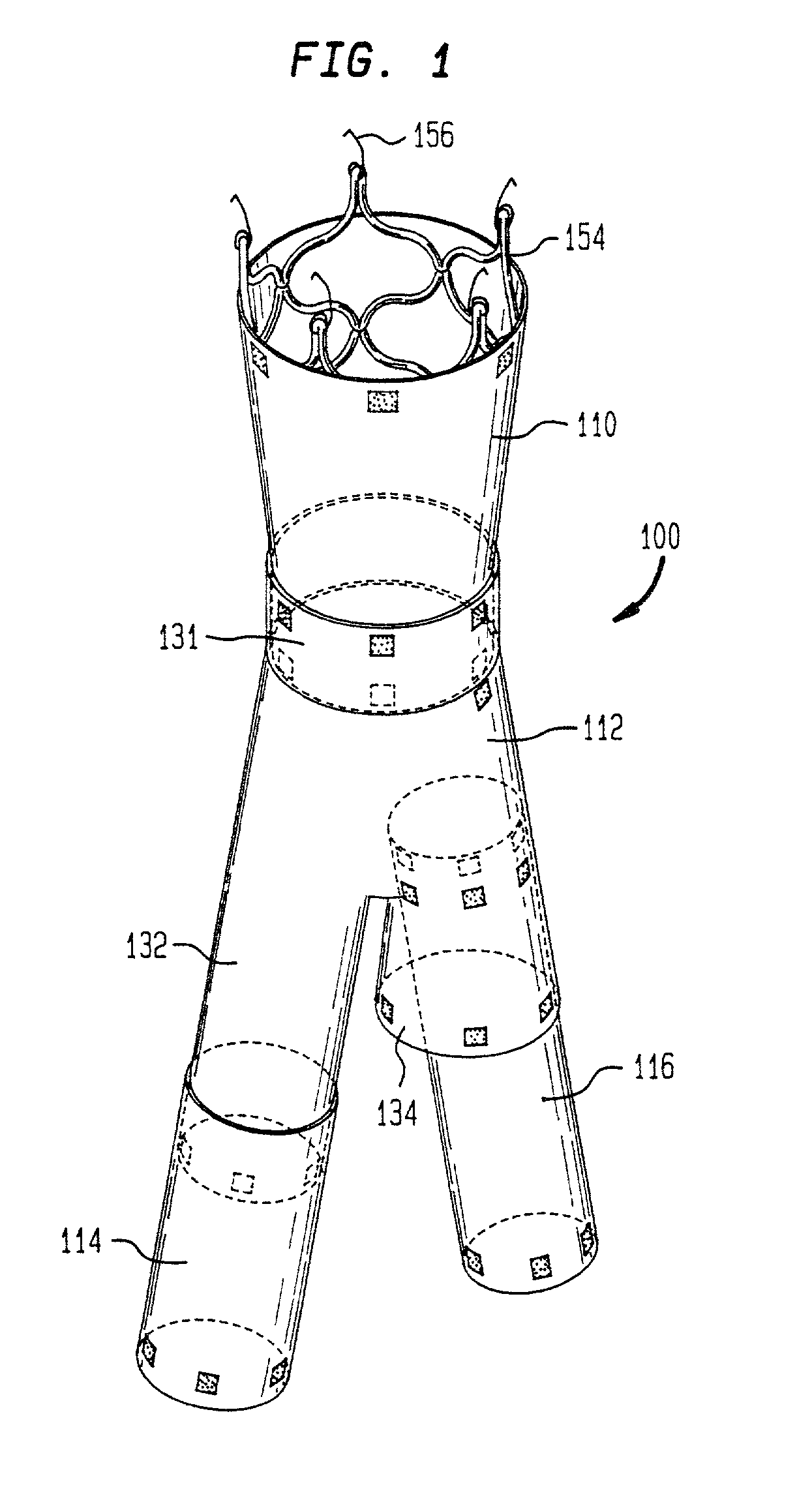 Bifurcated graft with an inferior extension