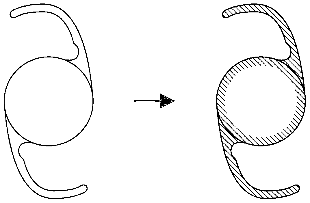 Method for preparing intraocular lens for preventing after-cataract based on photothermal conversion