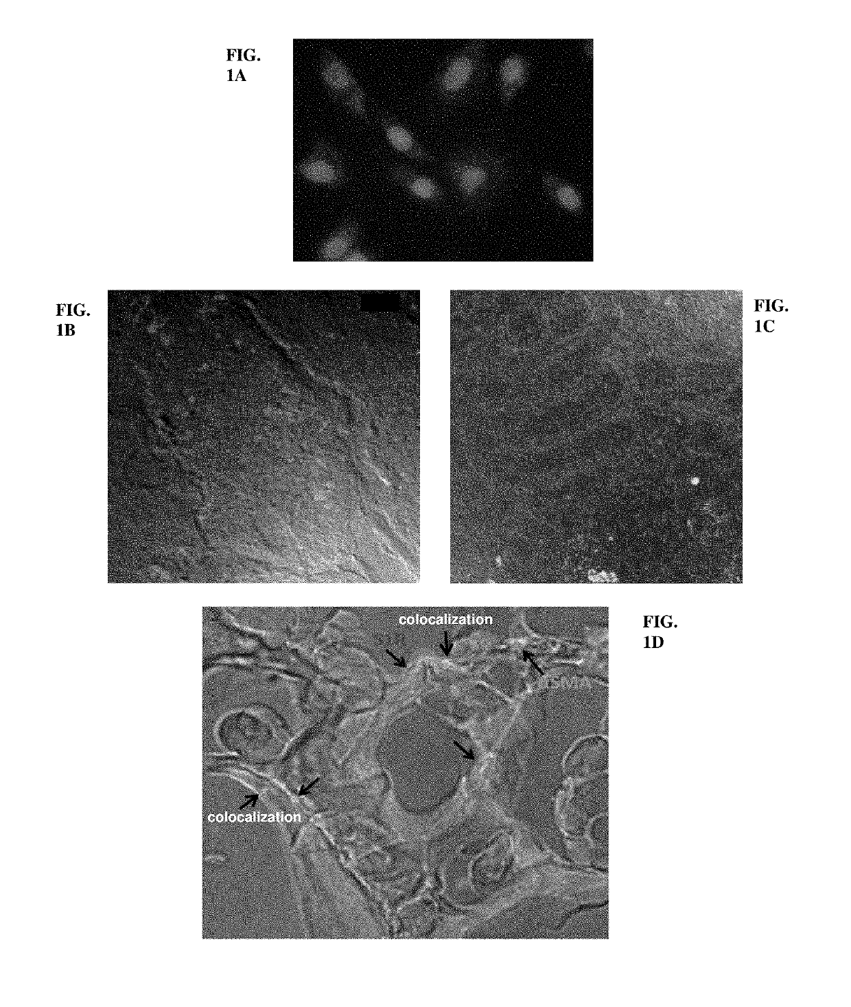 Novel use of sigma-1 receptor agonist compounds