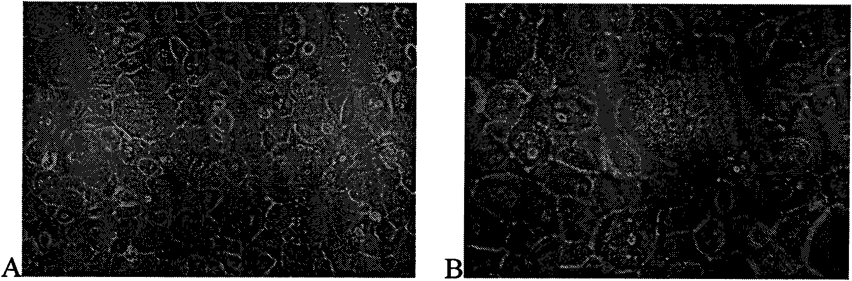 Chinese lung adenocarcinoma cell line with high metastases potentiality of bone, lever and salivary gland