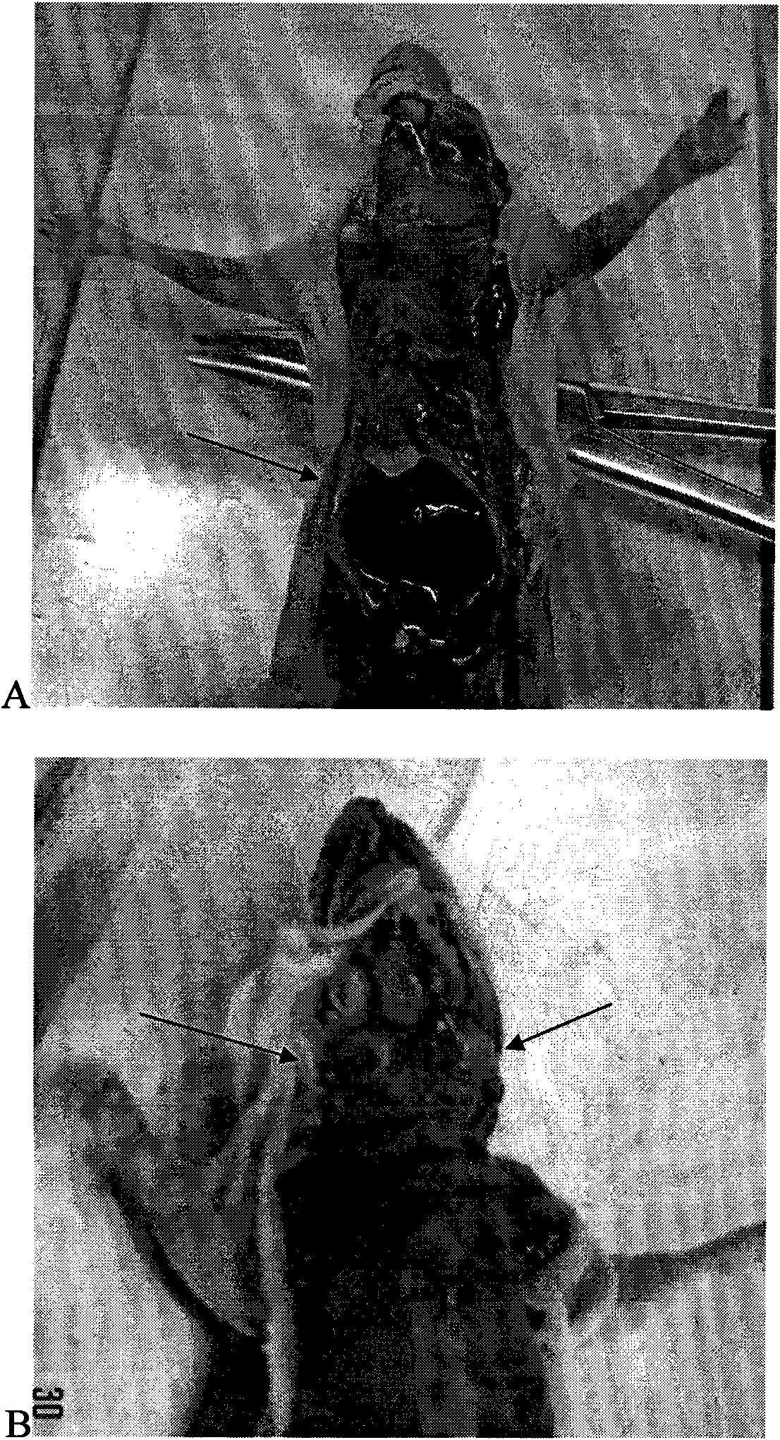 Chinese lung adenocarcinoma cell line with high metastases potentiality of bone, lever and salivary gland