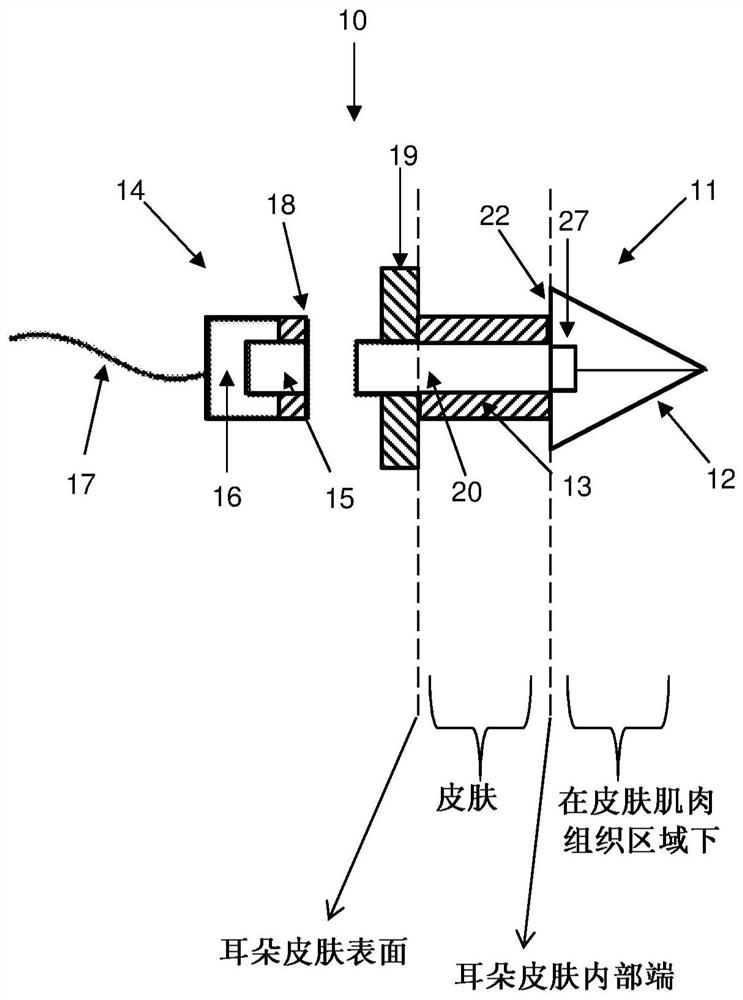 Effective electrical stimulation device for muscle location recognition and treatment response enhancement