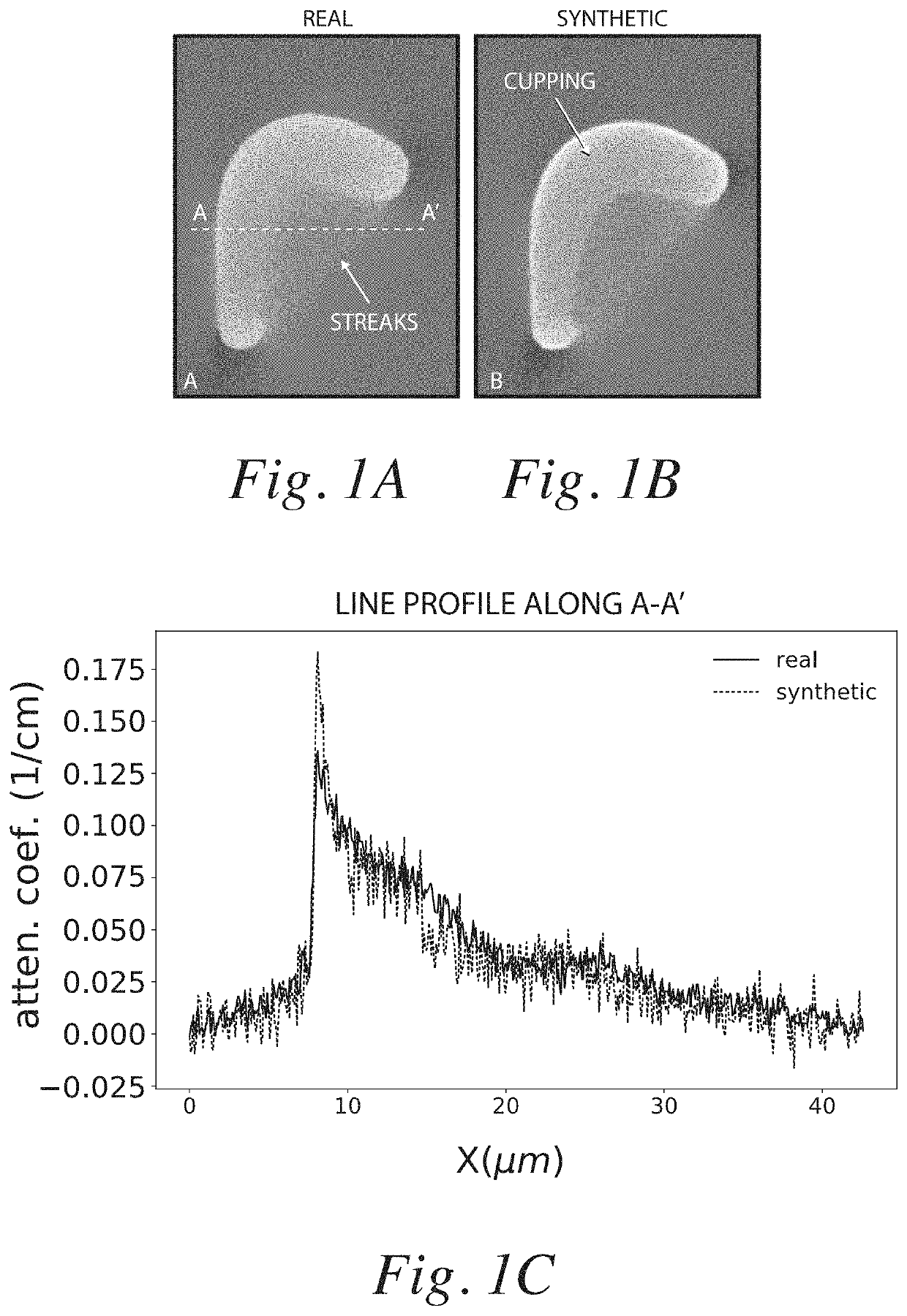 System and method for artifact reduction of computed tomography reconstruction leveraging artificial intelligence and a priori known model for the object of interest