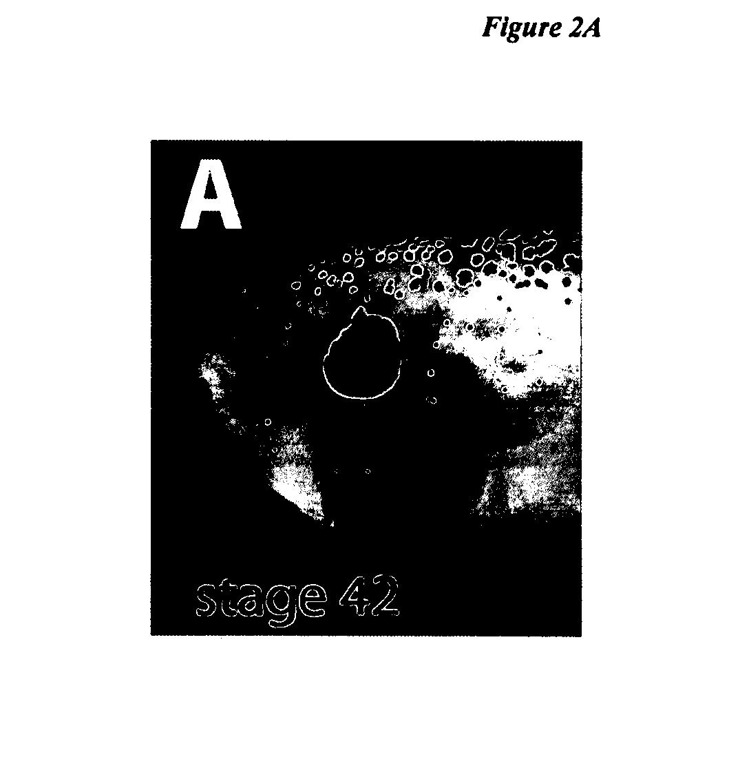 Retinal stem cell compositions and methods for preparing and using same