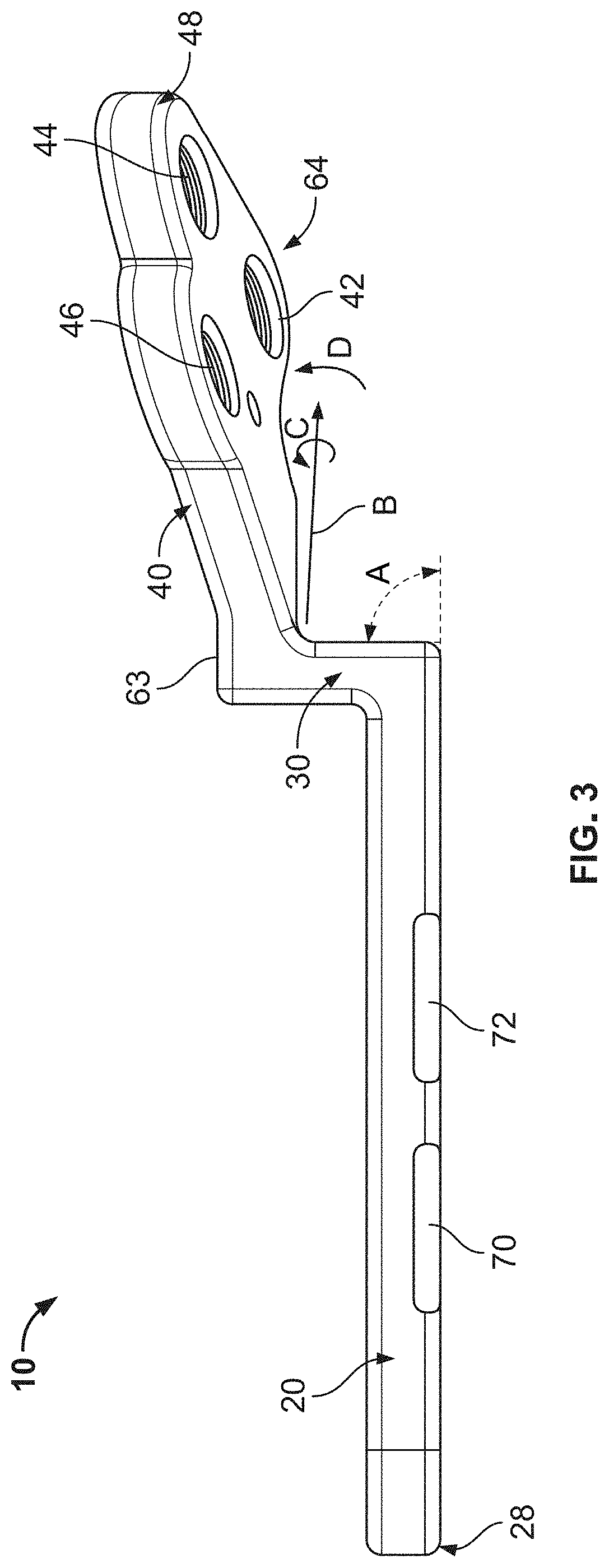 Tibial Plateau Leveling Osteotomy Plate with Offset