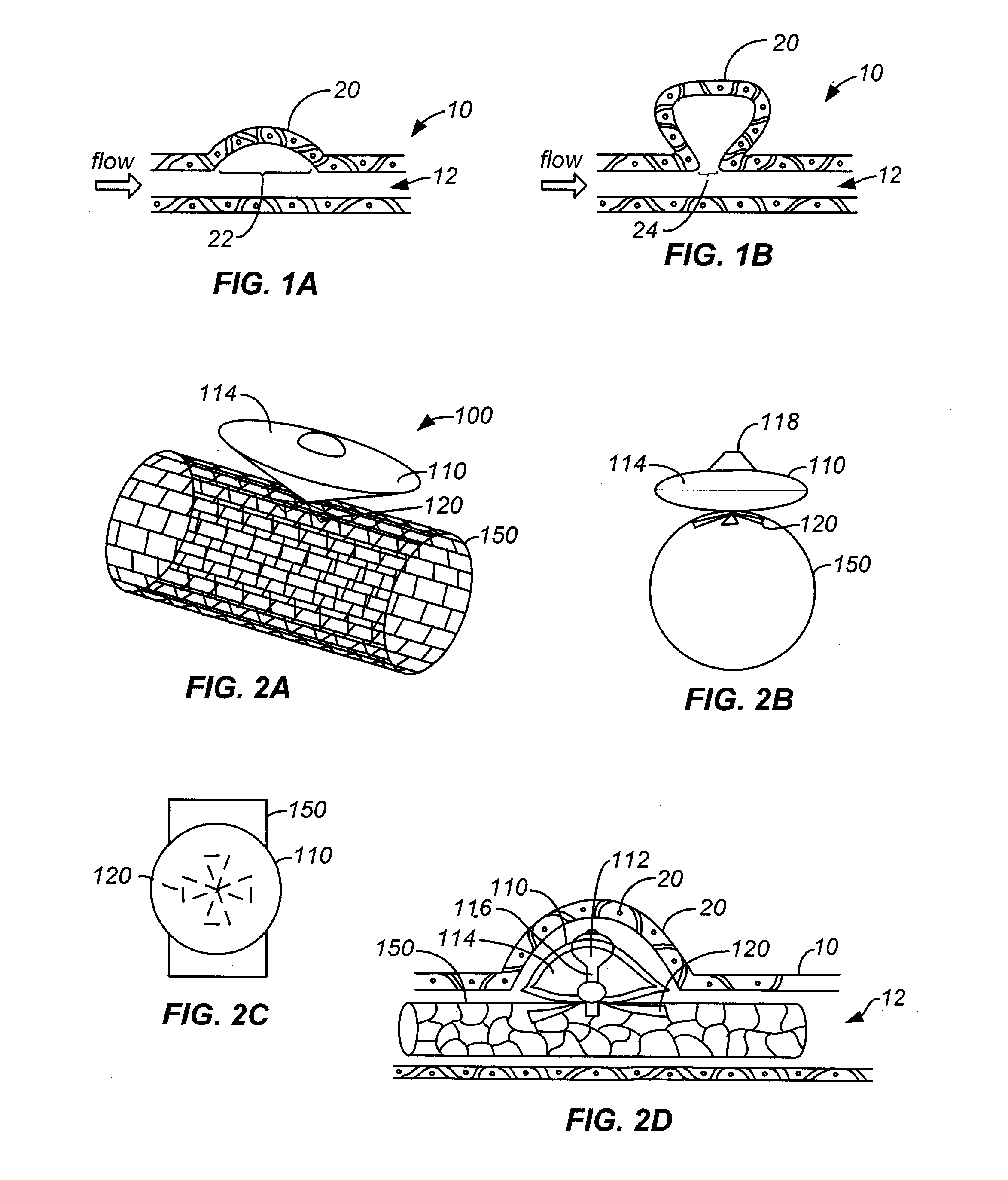 Aneurysm treatment devices and methods