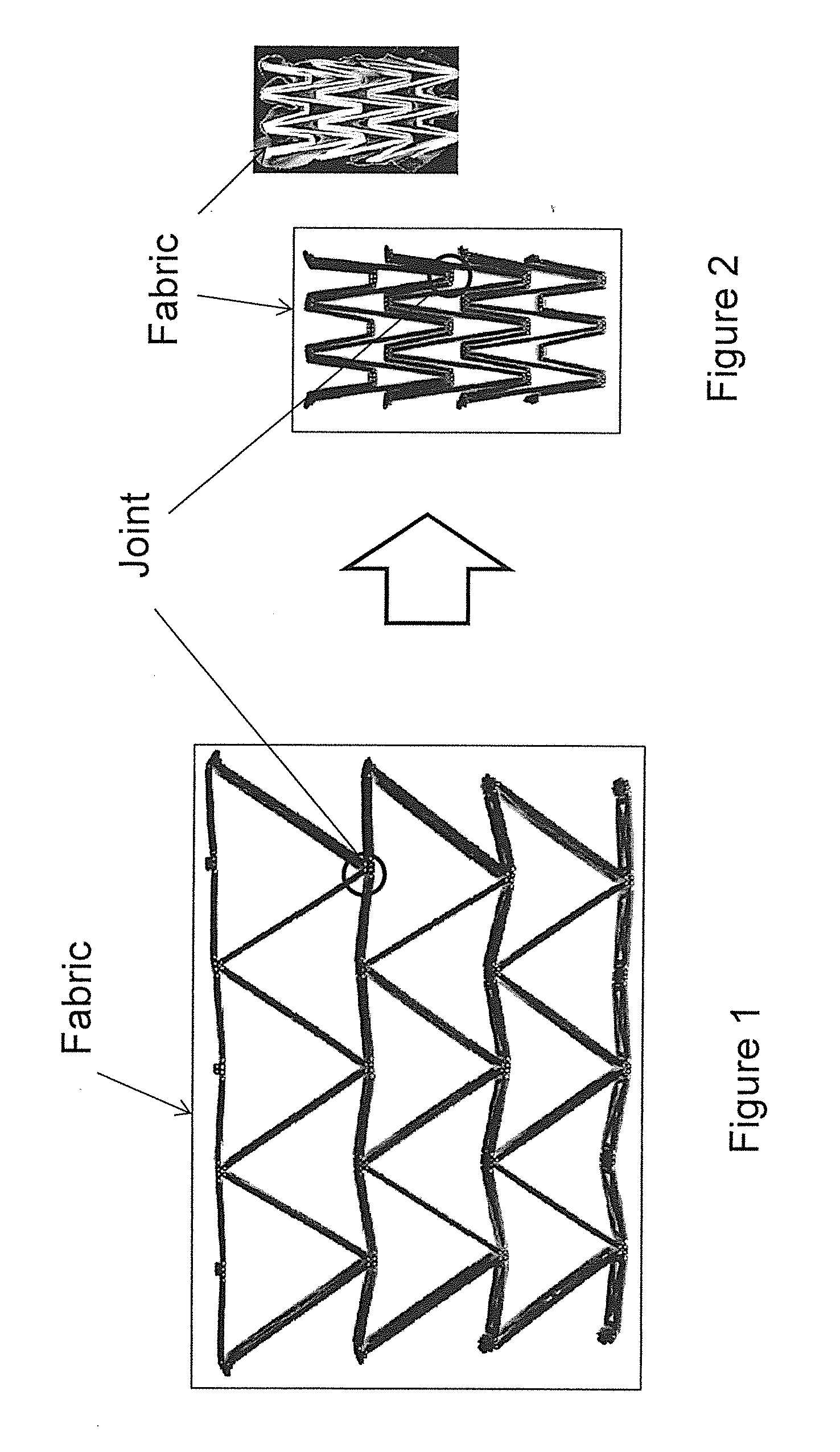 Rapidly deployable structures based upon negative poisson's ratio (NPR) auxetic components