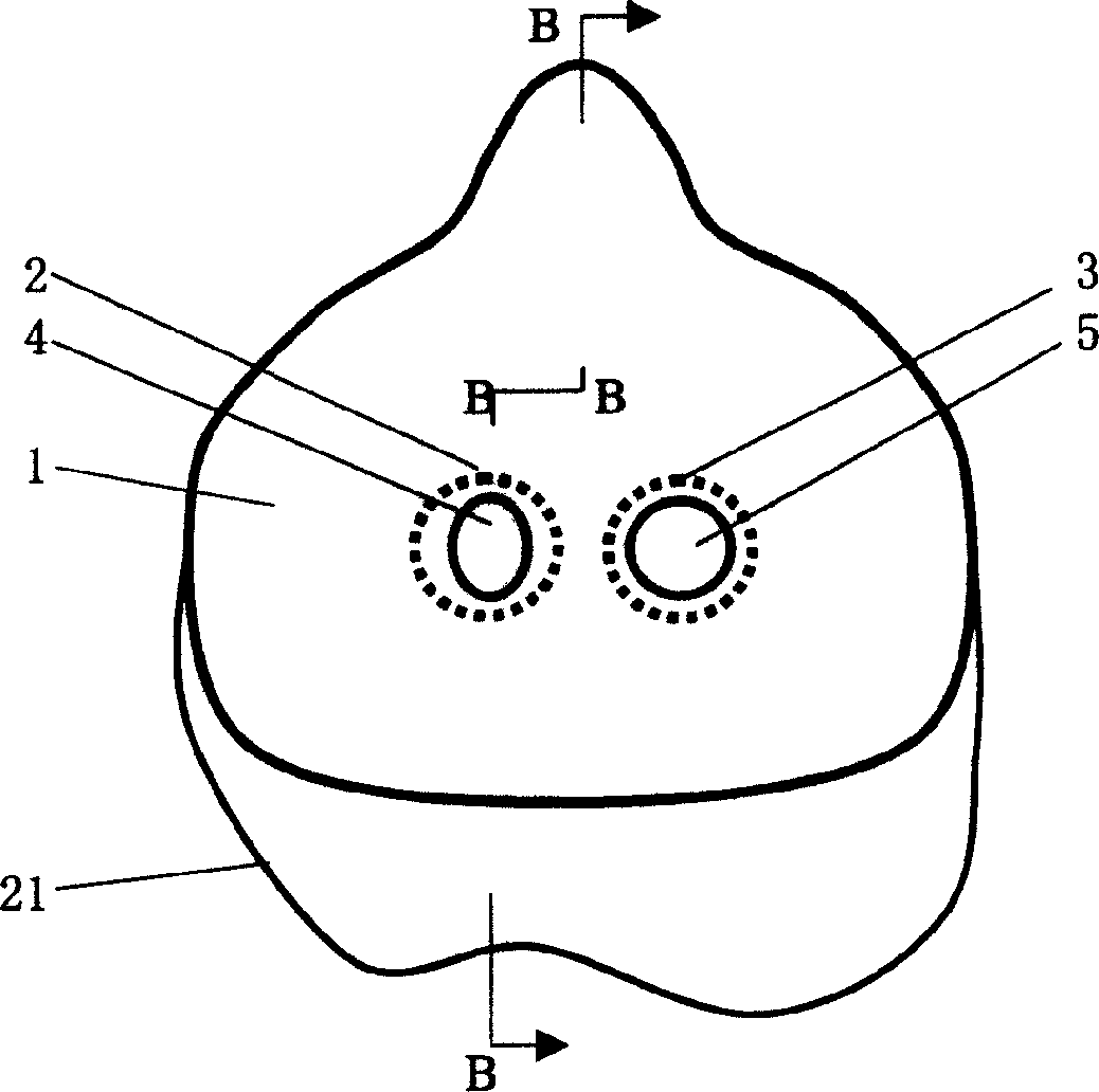 Mouth mask special for respiratory tract infectious disease sickrooms and its using method