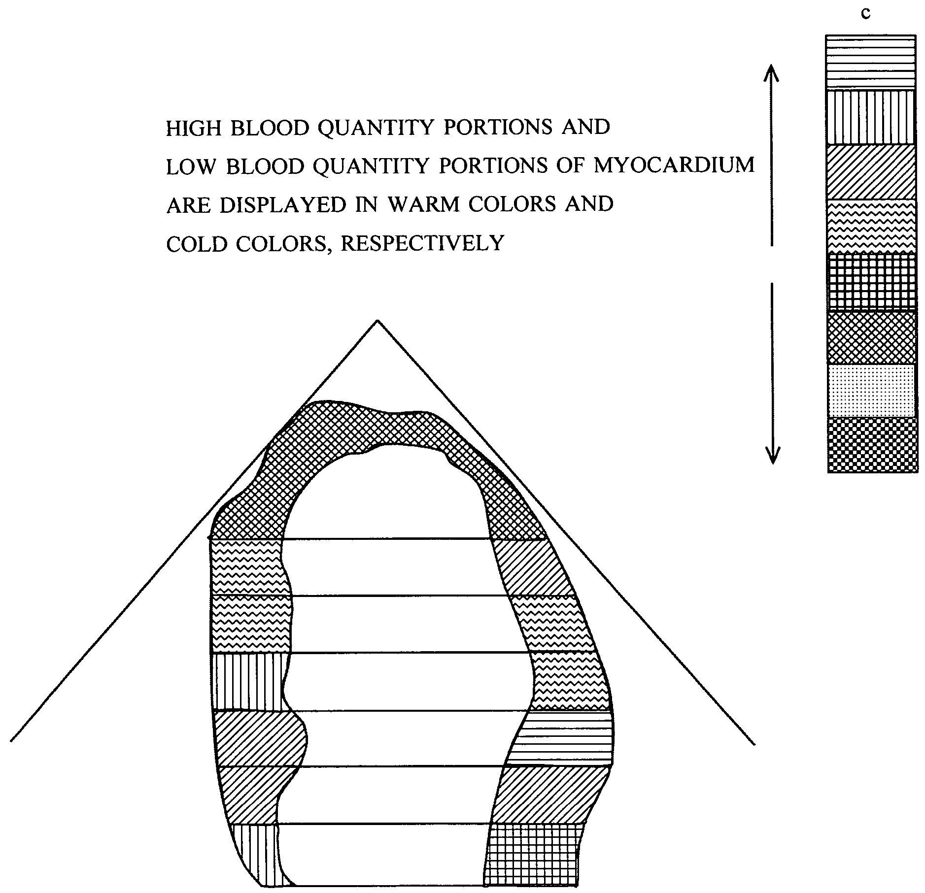 Method of analyzing and displaying blood volume using myocardial blood volume map