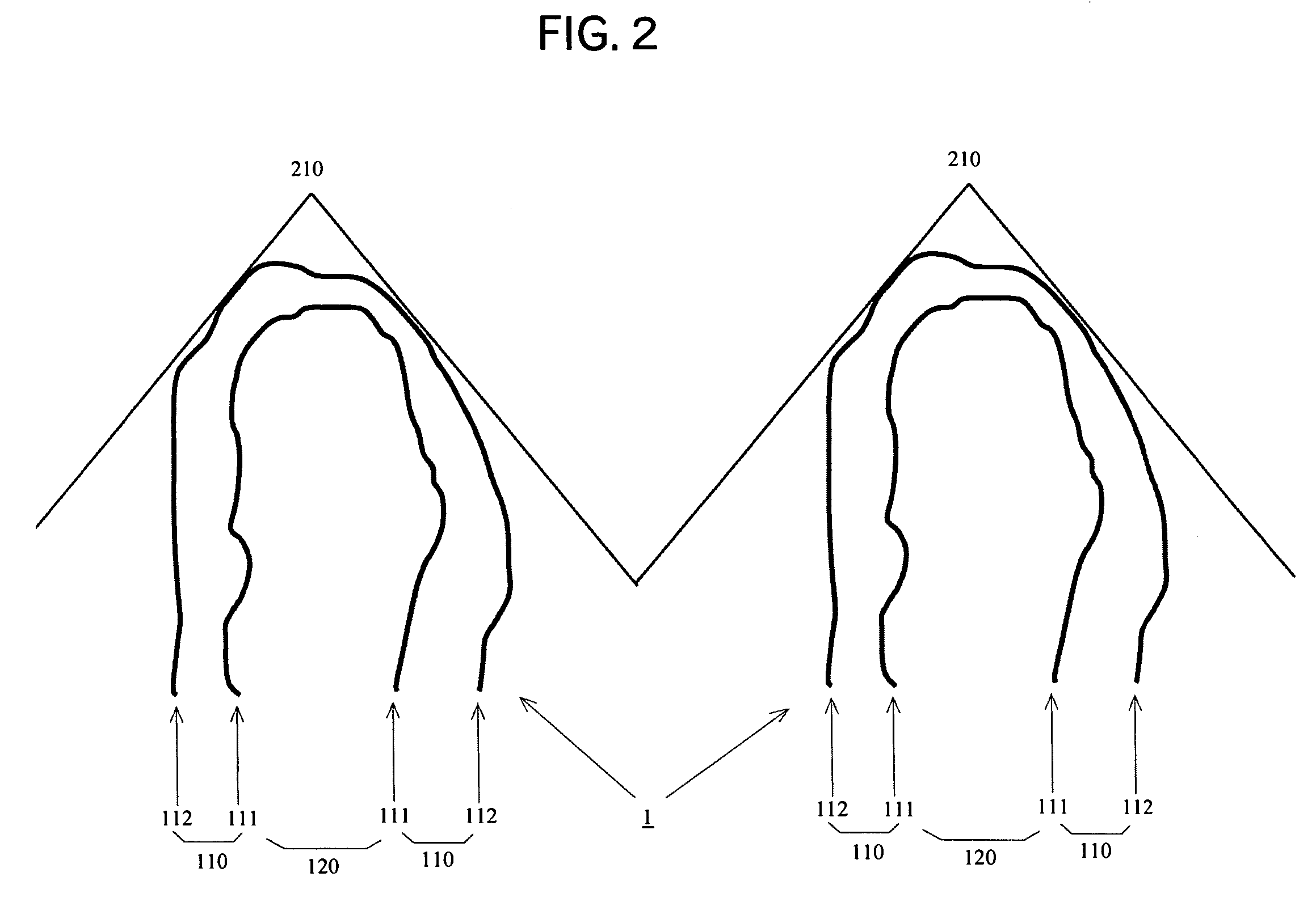 Method of analyzing and displaying blood volume using myocardial blood volume map