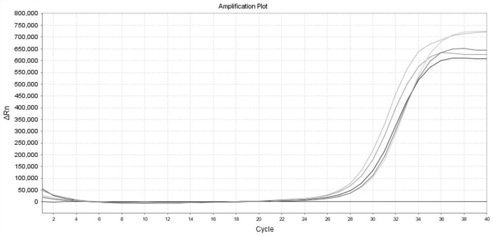 Y chromosome microdeletion detection kit