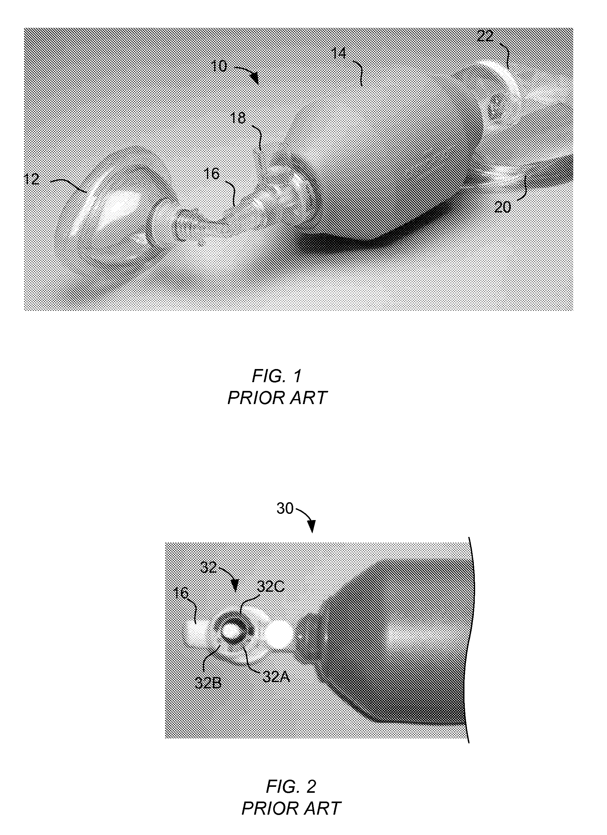 Resuscitation device with onboard processor