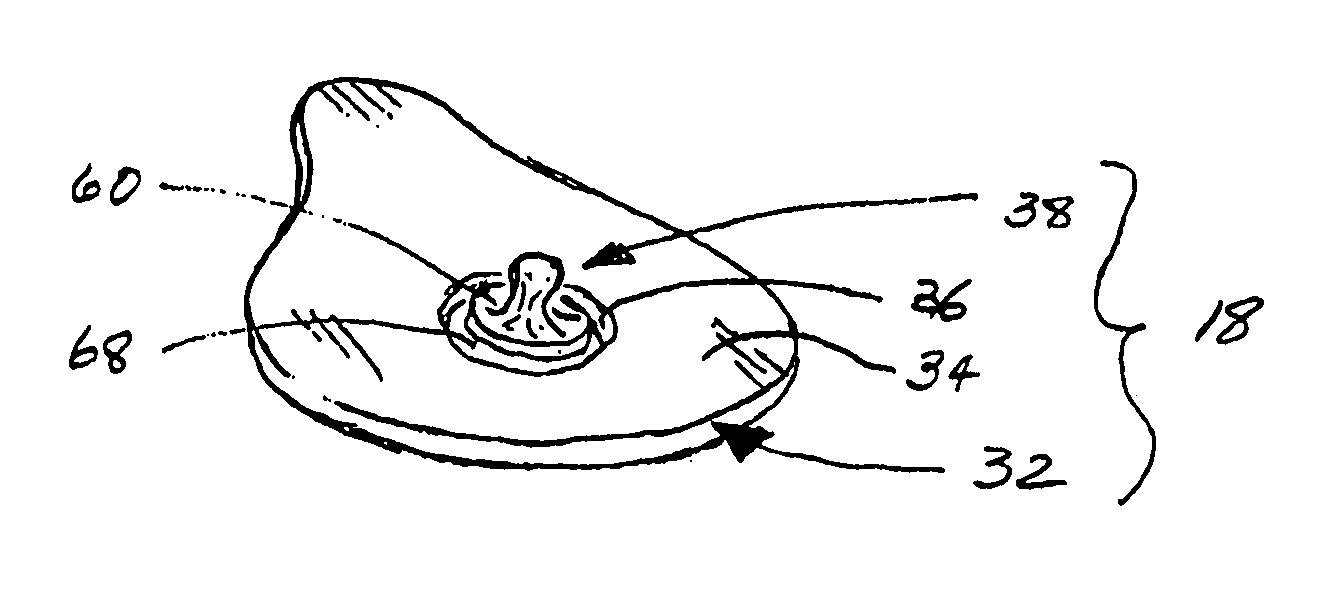 Active electrode for transdermal medicament administration