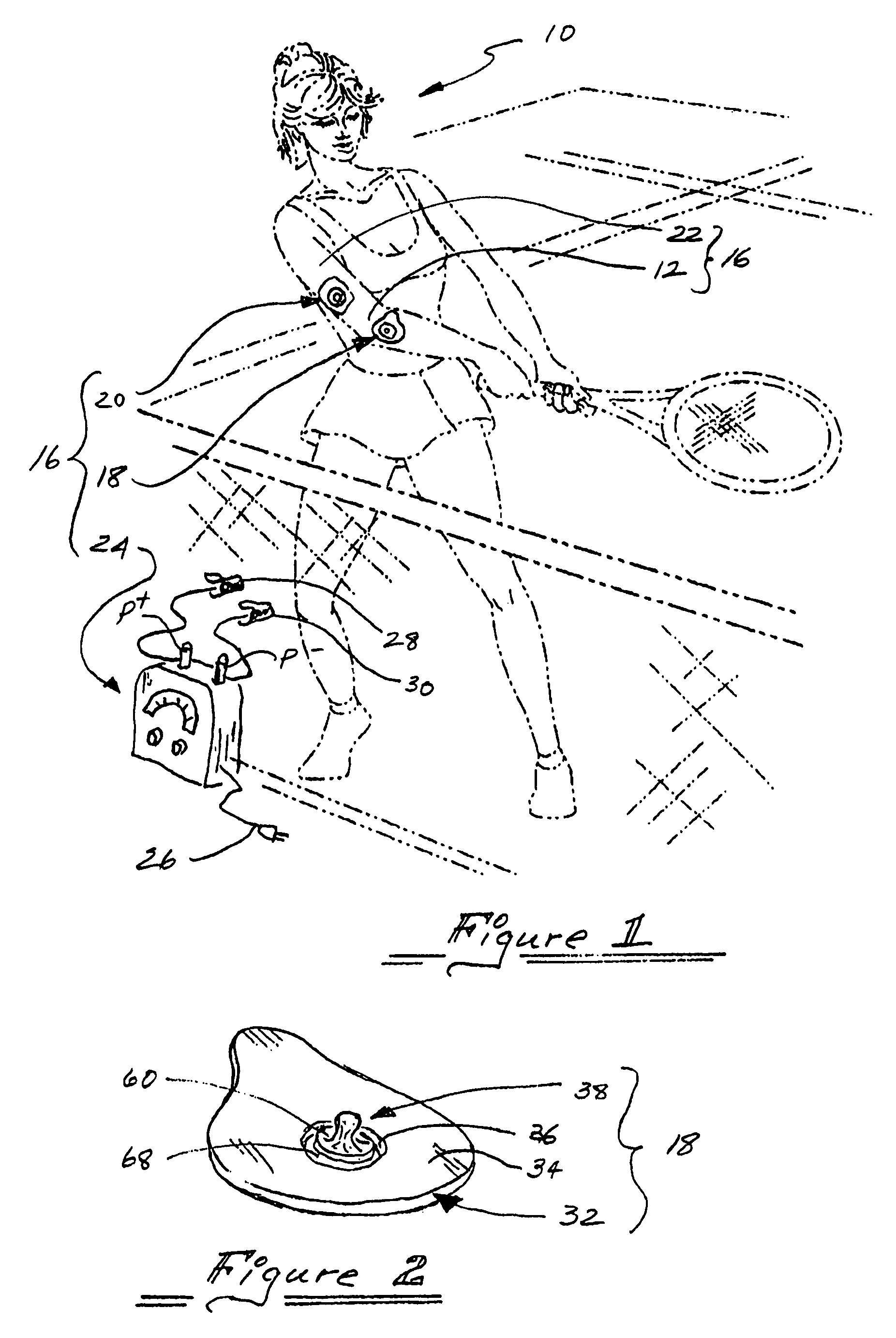 Active electrode for transdermal medicament administration