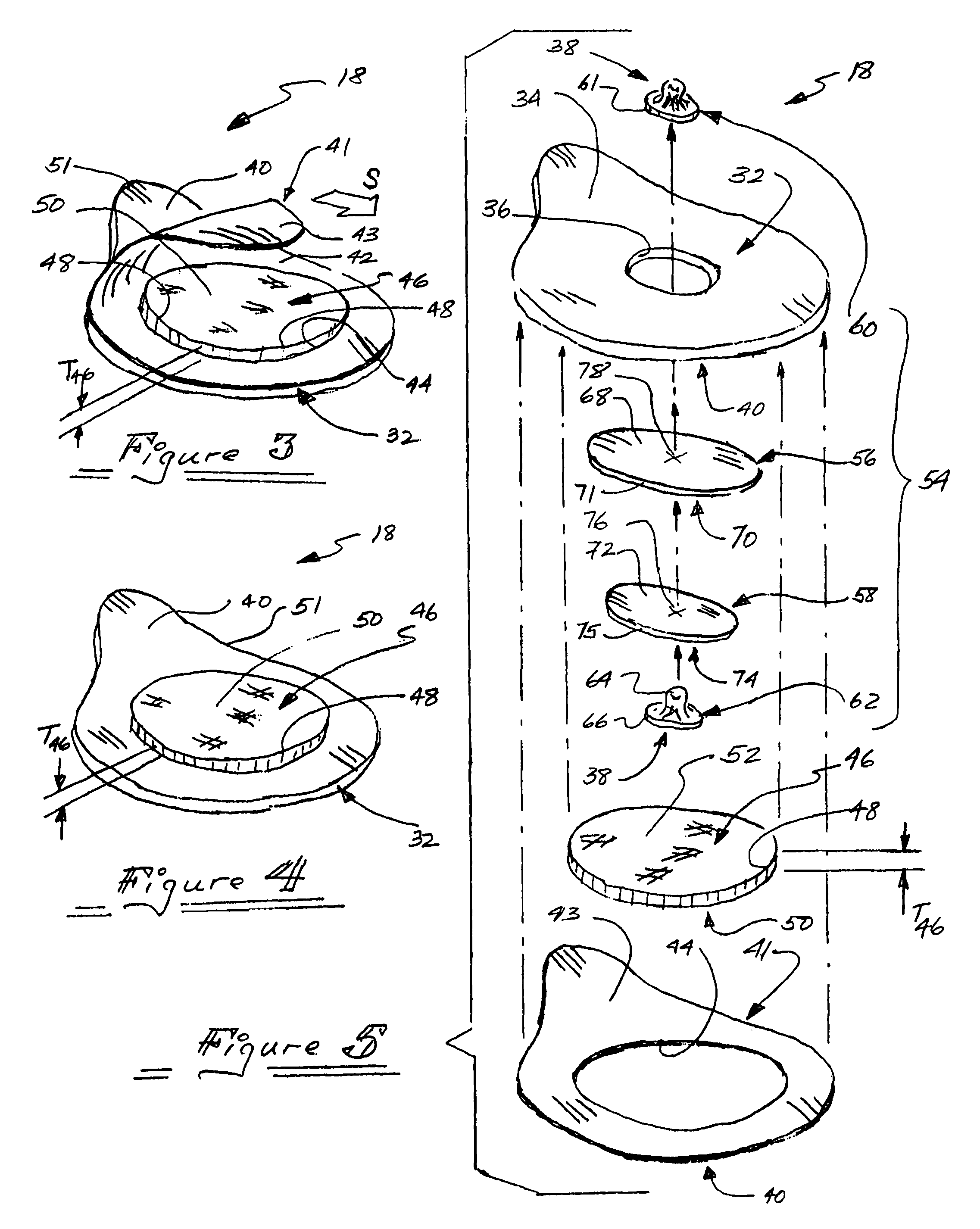 Active electrode for transdermal medicament administration