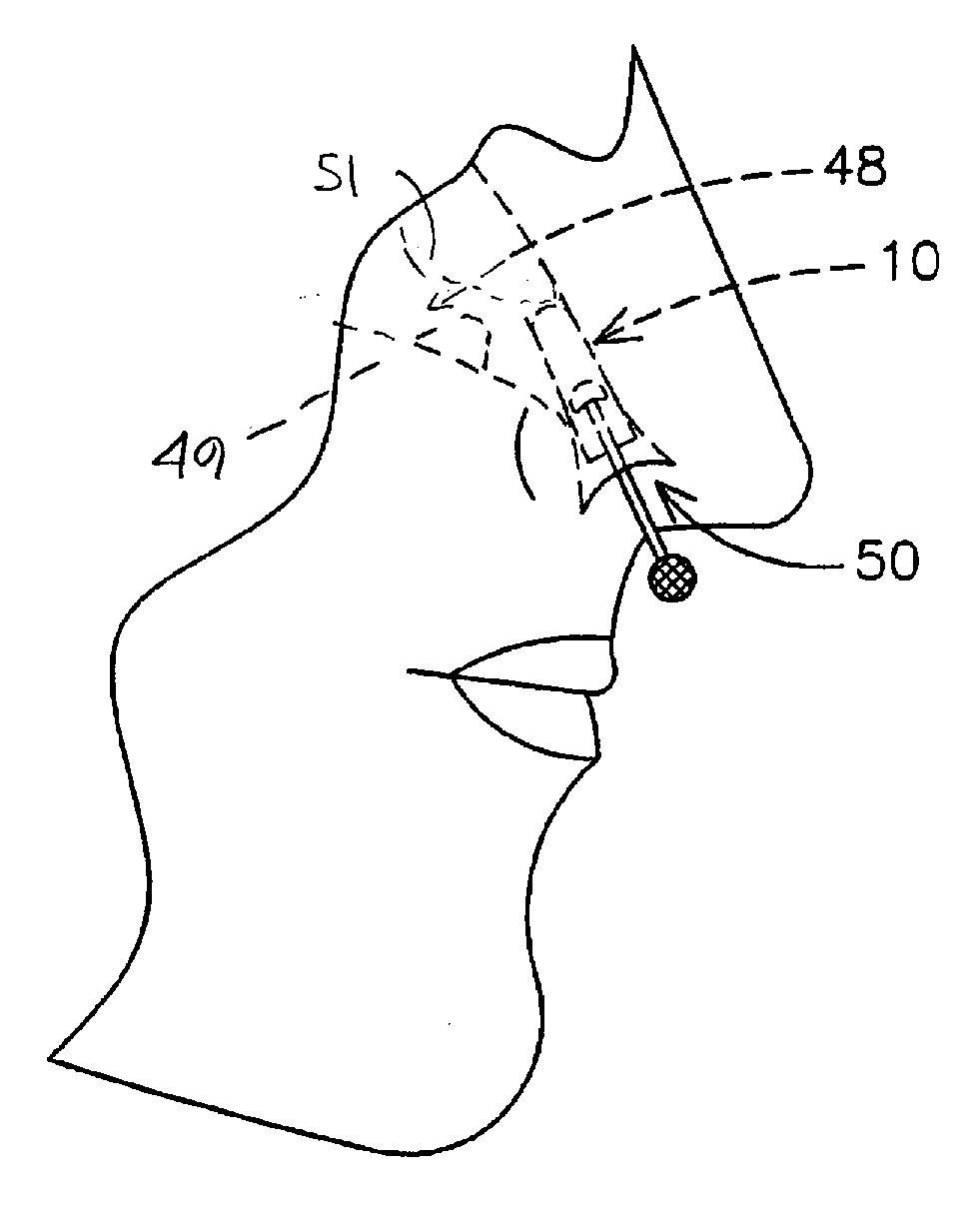 Method For Treating Nasal Irritation