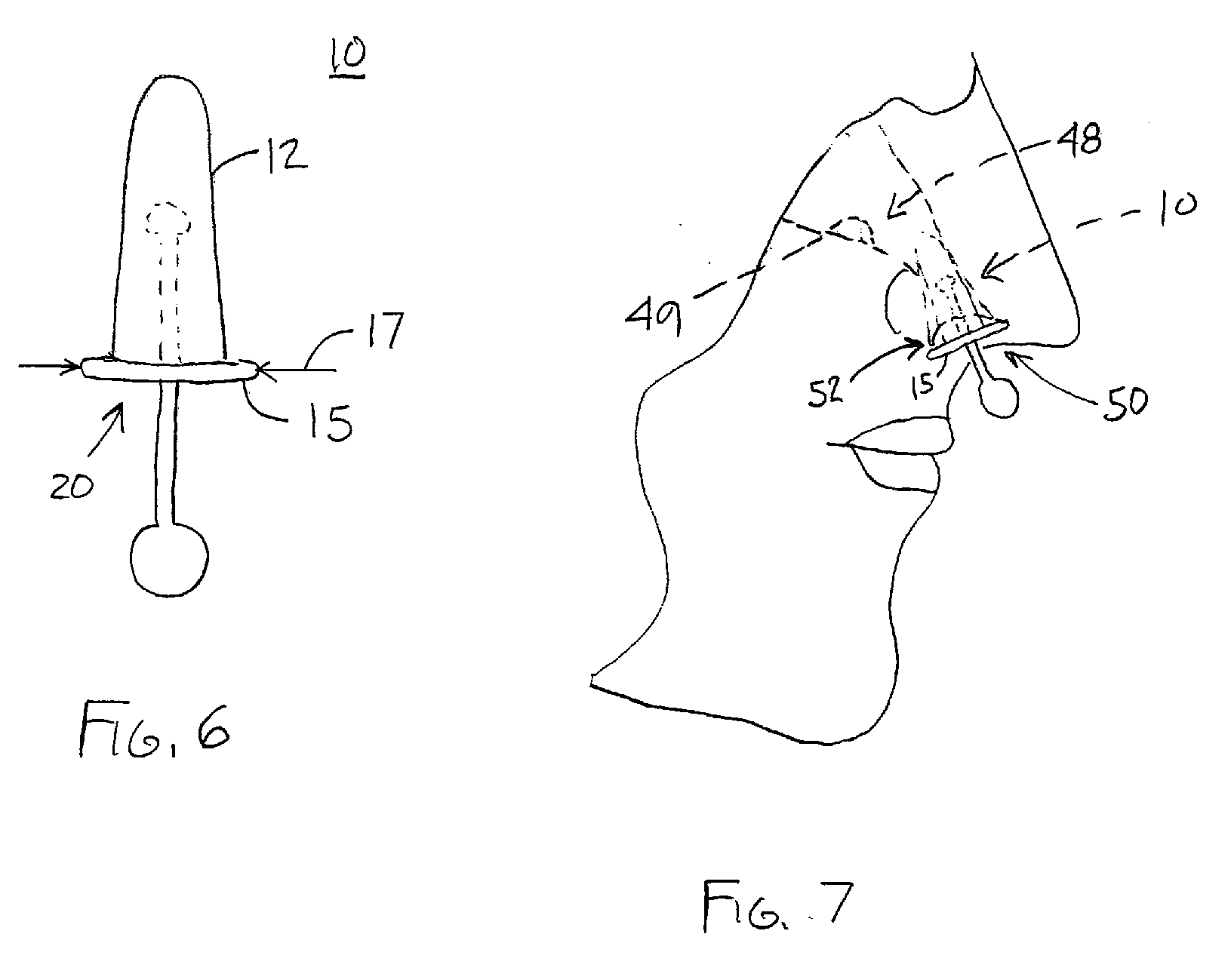 Method For Treating Nasal Irritation