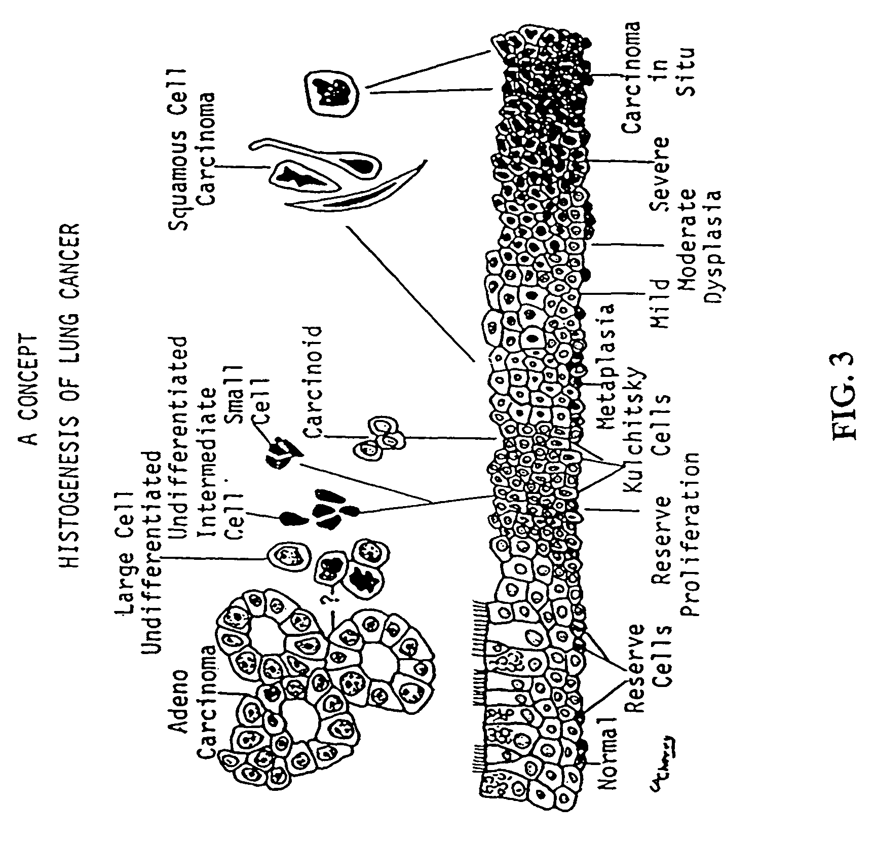 Detection and diagnosis of lung or upper airway cancers using 10Q22 as a biomarker