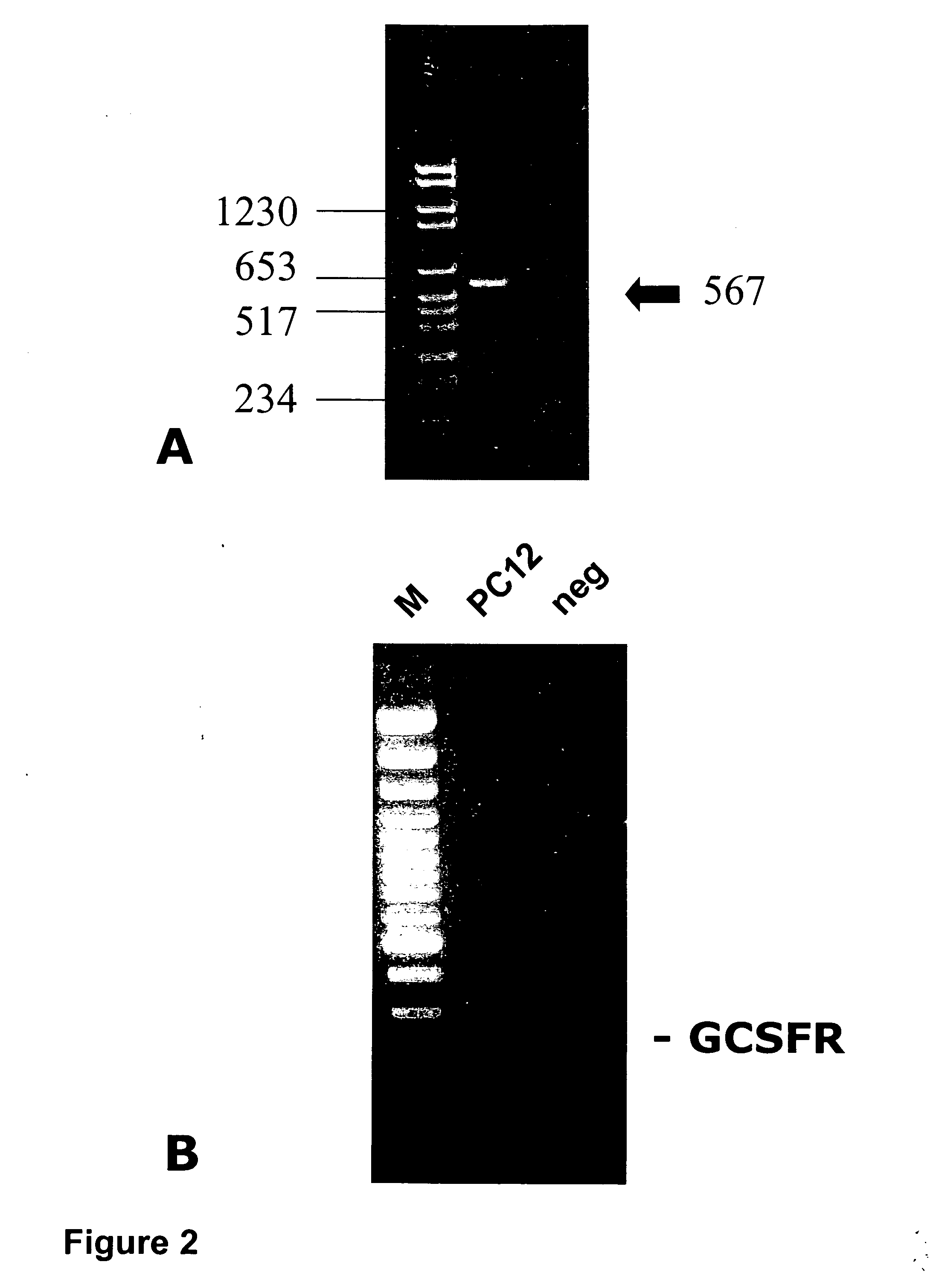 Methods of treating neurological conditions with hematopoeitic growth factors