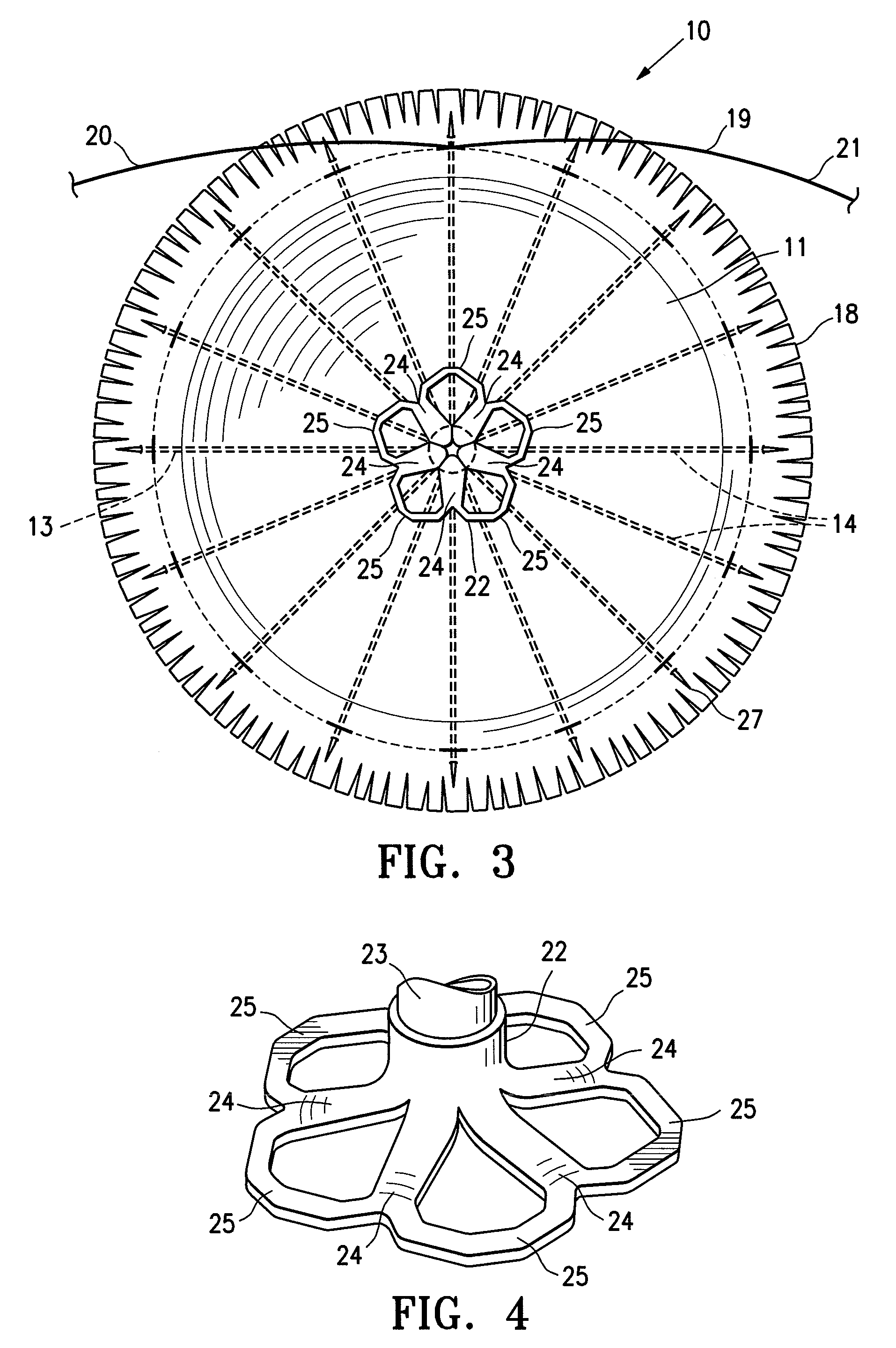 System for improving cardiac function by sealing a partitioning membrane within a ventricle