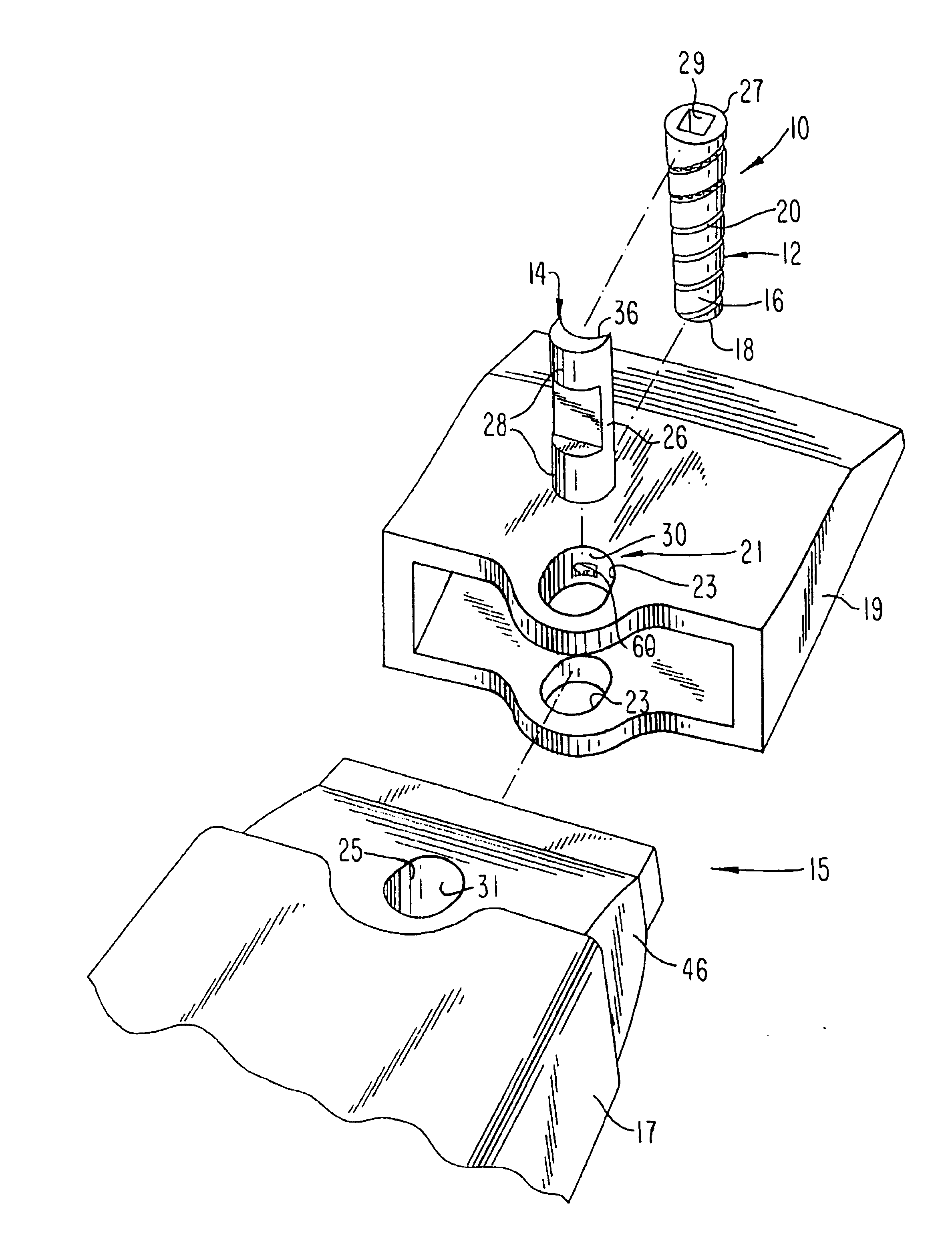 Releasable coupling assembly