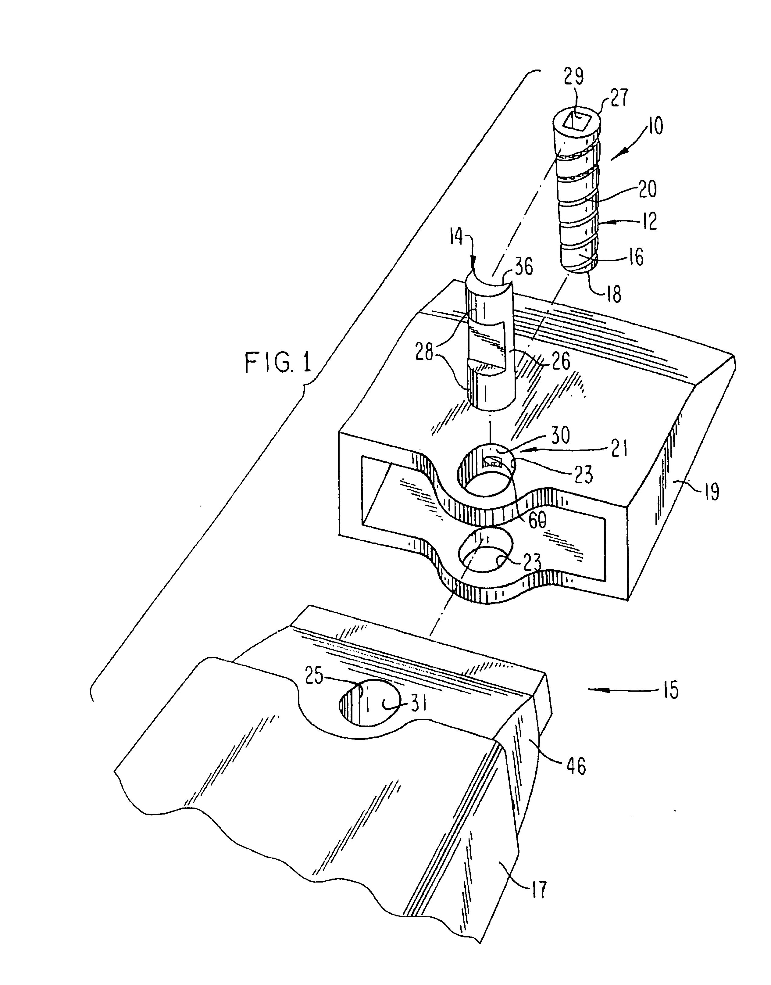 Releasable coupling assembly