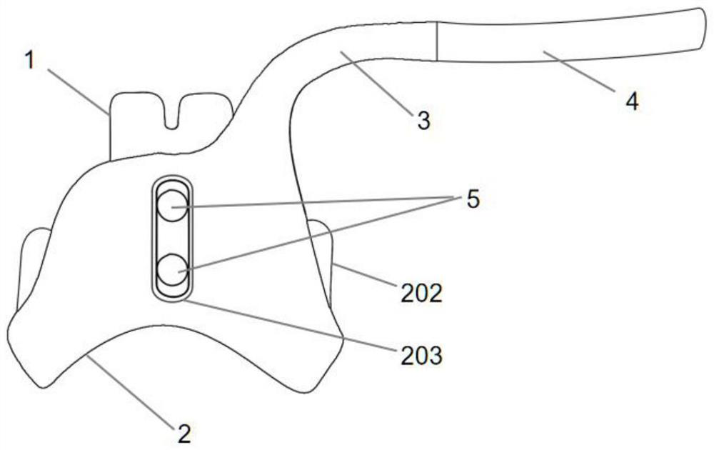 A kind of elastic internal fixation device of sternoclavicular joint