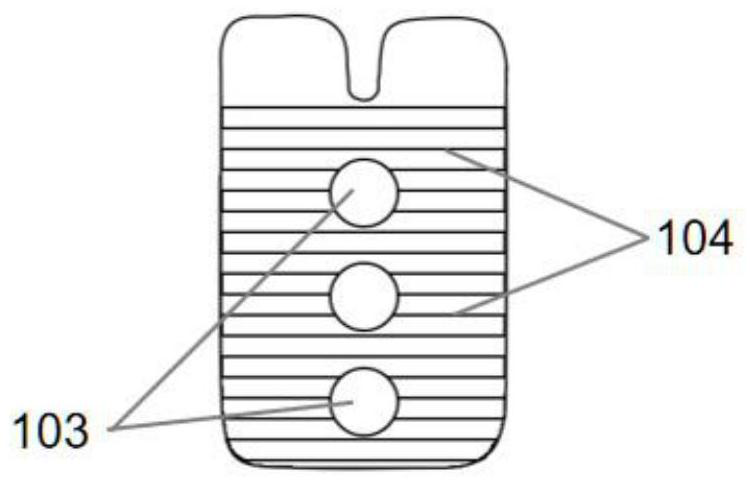 A kind of elastic internal fixation device of sternoclavicular joint