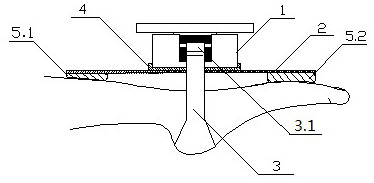 Ankle ligament stretching device