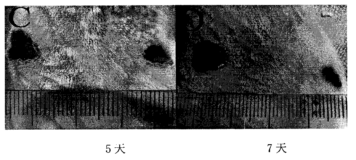 Starch-hyaluronic acid hemostatic agent and preparation method thereof