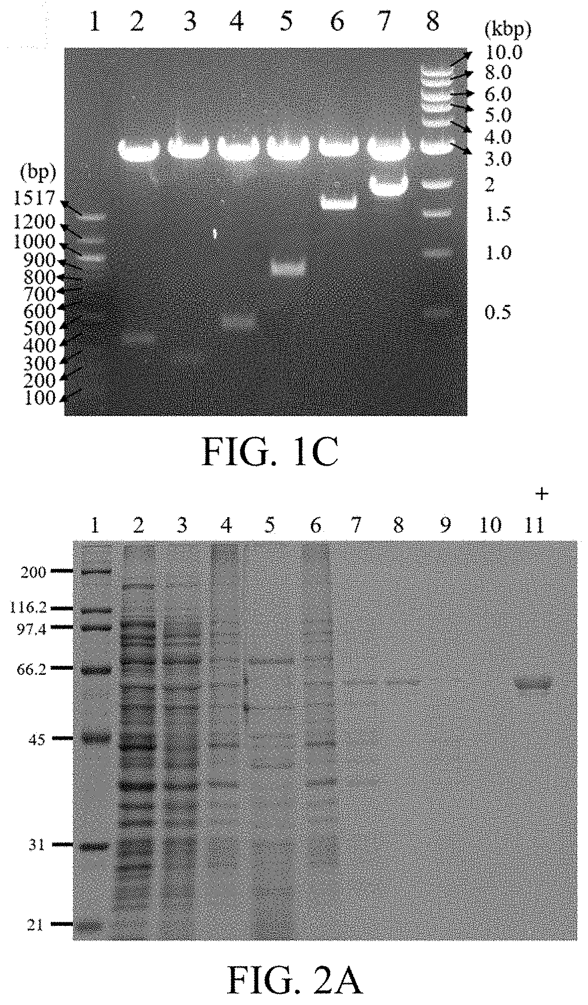 Pharmaceutical composition for preventing or treating diabetic complications